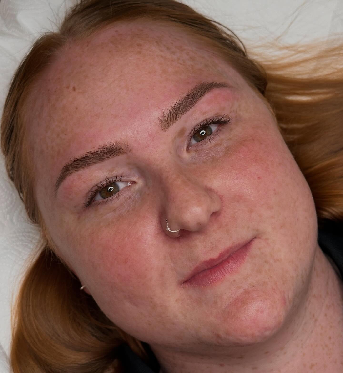 A beautifully healed cosmetic brow tattoo by Jadana, complemented with a tint and shape for soft definition and added depth ✨
We offer complimentary cosmetic brow tattoo consultations for those considering treatment. Bookings can be made through our online website.
#browtattoo #healedbrows #brows #embellir #dunedinnz