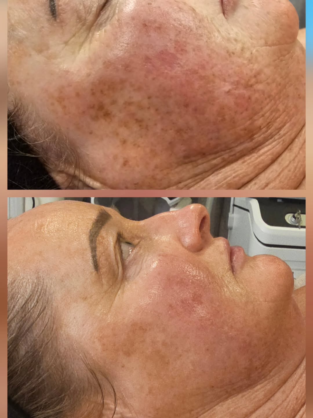 In salon treatments them homecare using @themask_anz. For this she used rejuvenation mode for 30 mins at night