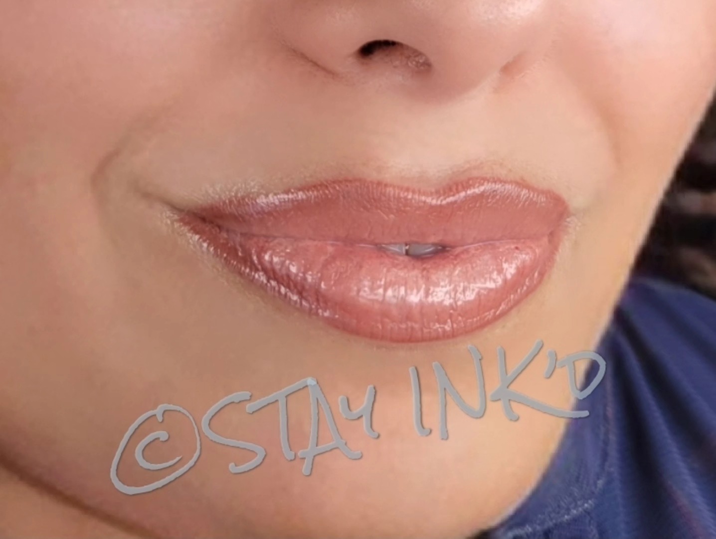Ombre Lips 💋💋💋
Swipe ⬅️ to see her before picture and final full-face results.
💋 Redefines the outer lipline, creating a bold 3D lip effect
💋 Utilizes a lighter/ complementary color for the inner portion of the lip tissue
💋 Results last 2 to 3 years
💋 Never have to reapply lipstick
Click BOOK NOW at www.stayinkd.com or on FB or Instagram. 📞 or text 904-933-INKD with any questions.