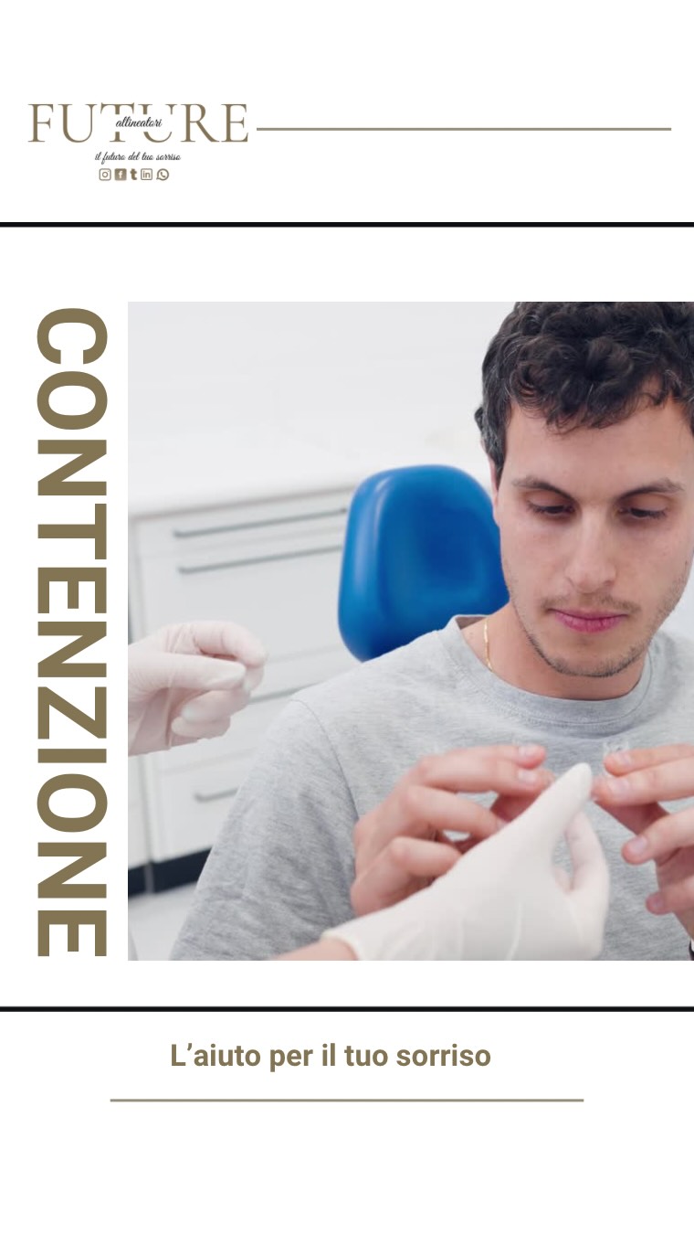 🦷 𝗛𝗔𝗜 𝗙𝗜𝗡𝗜𝗧𝗢 𝗟’𝗢𝗥𝗧𝗢𝗗𝗢𝗡𝗭𝗜𝗔? 𝗡𝗢𝗡 𝗙𝗔𝗥𝗘 𝗤𝗨𝗘𝗦𝗧𝗢 𝗘𝗥𝗥𝗢𝗥𝗘.
Molti pazienti pensano che, tolti gli allineatori, il trattamento sia finito.
❌ Sbagliato.
C’è una fase fondamentale che determina se il tuo sorriso resterà perfetto negli anni oppure no:
✨ 𝗟𝗔 𝗖𝗢𝗡𝗧𝗘𝗡𝗭𝗜𝗢𝗡𝗘
Dopo aver spostato i denti, l’osso e i tessuti hanno bisogno di tempo per stabilizzarsi nella nuova posizione.
Senza contenzione, i denti possono ritornare lentamente dove erano prima.
⚠️ Questo fenomeno si chiama recidiva ortodontica.
𝗖𝗼𝗺𝗲 𝗳𝘂𝗻𝘇𝗶𝗼𝗻𝗮?
✔ All’inizio si indossa per diverse ore al giorno
✔ Successivamente principalmente di notte
✔ È trasparente, sottile e molto confortevole
💡 La verità che molti non dicono:
Il trattamento allinea i denti…
𝗹𝗮 𝗰𝗼𝗻𝘁𝗲𝗻𝘇𝗶𝗼𝗻𝗲 𝗺𝗮𝗻𝘁𝗶𝗲𝗻𝗲 𝗶𝗹 𝗿𝗶𝘀𝘂𝗹𝘁𝗮𝘁𝗼.
👉 Se vuoi che il tuo nuovo sorriso resti perfetto nel tempo, la contenzione non è un’opzione.
È parte del trattamento.
🌐 Scopri di più su:
www.futureallineatori.it
✨ Il tuo sorriso è un investimento. Proteggilo.
#allineatoritrasparenti #ortodonzia #sorrisoperfetto #dentista #allineatori futureallineatori