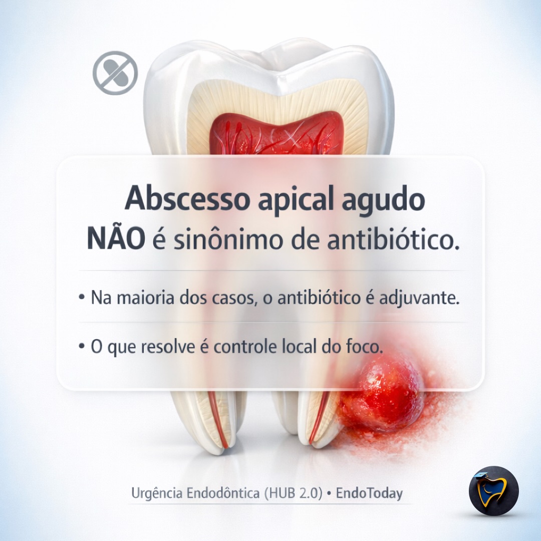 Neste post do blog, eu organizei a conduta em um algoritmo reprodutível em 8 passos, com tabela decisória e um checklist de 1 minuto para você não cair no erro mais comum:
✅ tratar a ansiedade do plantão com antibiótico
❌ em vez de tratar o foco infeccioso com intervenção local
O que você vai levar do conteúdo (e aplicar já na próxima urgência):
Triagem de gravidade em 60s (quando o caso “vira sistêmico”)
Critérios objetivos para indicar antibiótico (e quando NÃO indicar)
Sequência operatória que reduz dor, pressão e carga microbiana
Checklist salvável para decisão rápida, documentada e segura
📌 Leia o post completo no blog (link na bio) e salve este carrossel para usar como “cola” na cadeira.
Agora, se você quer dominar isso ao vivo, com repetição e casos reais, vem comigo:
🔥 Imersão Emergência Endodôntica — Abril/2026
📍 Presencial • AORP Ribeirão Preto–SP
🎯 Checklists + algoritmos + tomada de decisão em “cadeira quente”
📲 Informações e inscrição no WhatsApp: +55 16 3995-4145
Escreva “URGÊNCIA” que eu te envio os detalhes.
#endodontia #urgenciaodontologica #antibioticos #diagnosticoendodontico #abscessoapical