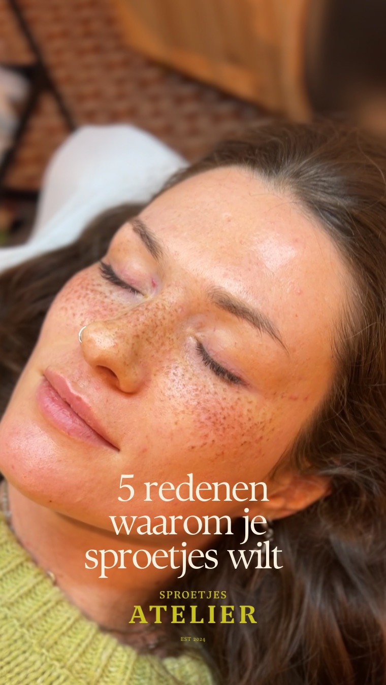 5 redenen waarom je vandaag nog sproetjes wilt zetten💃
* Allereerst: sproetjes zijn mooi. Punt. Hoeven we niet over te discussiëren.
* En belangrijker: Faux Freckles tattoos zijn op basis van PMU. Semi permanent dus. Je kunt genieten van een tijdelijk sproetenfeestje 🎉
* Jij bepaald je eigen look. Ja echt!? Neem je favoriete Pinterest foto mee en krijg je droomsproetjes🔥
* Sproetjes tattoos zijn net echt! Niemand die ziet dat ze zijn getatoeëerd. Lekker ownen die complimenten 💃
* En als laatste: als je sproetjes laat plaatsen, doe het dan goed! Kies voor Carmen, dé artiest op dit gebied