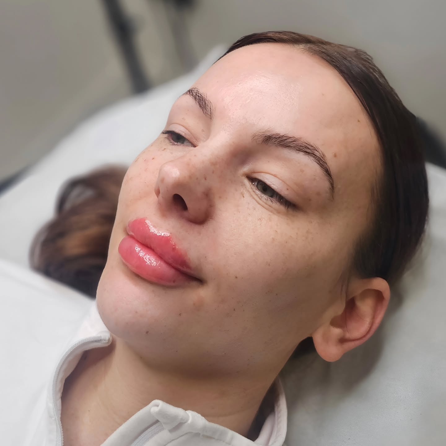 Lip Filler by Sam S
Subtle, balanced enhancement designed to complement your natural features. Whether you want soft hydration, improved symmetry or a little extra volume, every treatment is tailored to you.
Using advanced techniques and high quality dermal fillers, Sam focuses on creating natural looking results while maintaining lip structure and movement.
Treatment includes:
Full consultation
Facial assessment
Precision lip enhancement
Aftercare guidance
Perfect for
Lip definition
Volume restoration
Balancing asymmetry
Hydration and smoothness
Results are visible immediately with full settling in around 2 weeks.
Consultations available.
Appointments available at Essex Beauty & Aesthetics.
#essexlips #essexlipfiller #basildonlipfillers #lipfiller