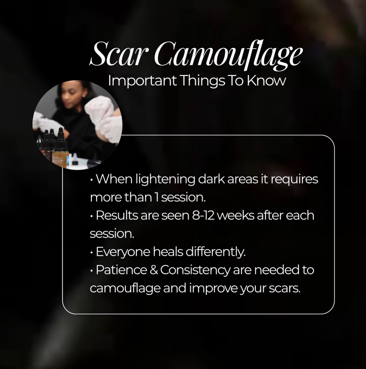 Patience & Consistency Are Key!
Patience and consistency are critical in scar camouflage because the process is a gradual, multi-session journey rather than a one-time fix, often requiring 3–4 sessions for full, natural-looking results. Because scar tissue is thinner and behaves differently than healthy skin, it requires a slow, gentle approach to build pigment and improve texture without damaging the area.
Let’s begin your camouflage journey today at BEATANDBLADE.COM
#scarcamouflage #tattoo #medicaltattoo #paramedicaltattoo