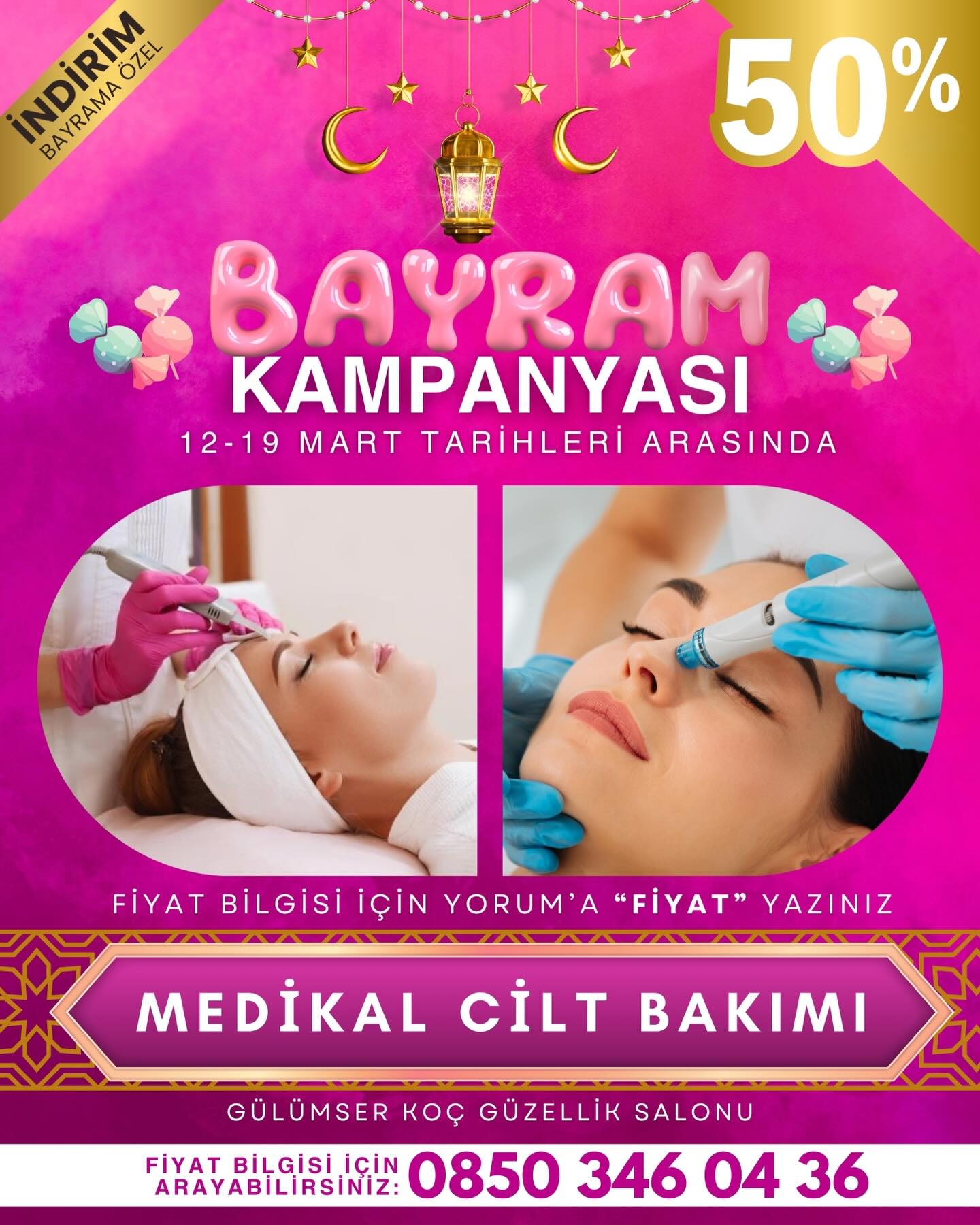 🍬 BAYRAM’A ÖZEL %50 İNDİRİM KAMPANYAMIZ BAŞLADI 🎉🎁
MEDİKAL CİLT BAKIMI İŞLEMİ %50 İNDİRİMDE 💕
FİYAT BİLGİSİ İCİN YORUMA “FİYAT” YAZINIZ.
KAMPANYAMIZ 12-19 MART TARİHLERİ ARASINDADIR 📅
BÜYÜK KAMPANYAYI KAÇIRMAMASI İÇİN BU GÖNDERİYİ ARKADAŞINA GÖNDER ✅
GÜLÜMSER KOÇ GÜZELLİK SALONU
0850 346 0 436