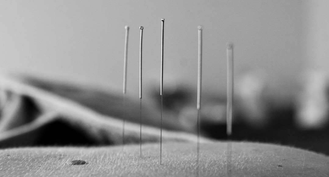 It is ok to be a little needle phobic, everyone is I think. The thing is, some times you need the needles to get the benefits. Give acupuncture a go to see how it can help.
www.acupuncturehawkesbay.com