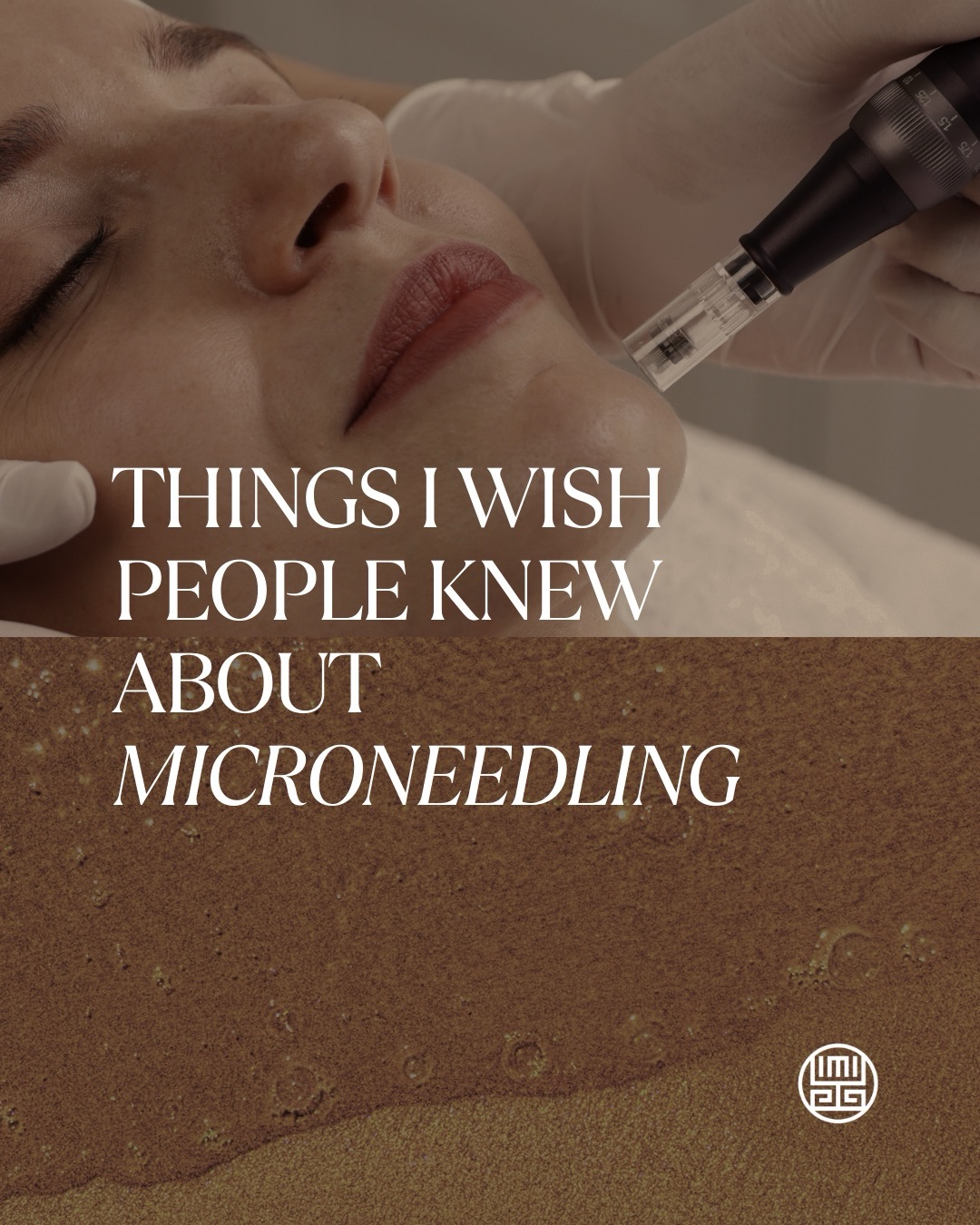 Things I wish more people knew about microneedling…
It’s not just about tiny needles — it’s about stimulating your skin to repair and build collagen. The real results happen weeks after your treatment, not the next day. 🧐
Another thing: one session isn’t usually enough. Microneedling works best as a series, gradually improving texture, fine lines, acne scars, and overall skin quality. 📈📈
And most importantly, depth, technique, and proper skin prep matter. When done correctly, microneedling can be one of the most effective treatments for long-term skin improvement. ✨
#microneedling #collagenboost #skintexture #acnescars #skintreatment #medspa #skinrejuvenation