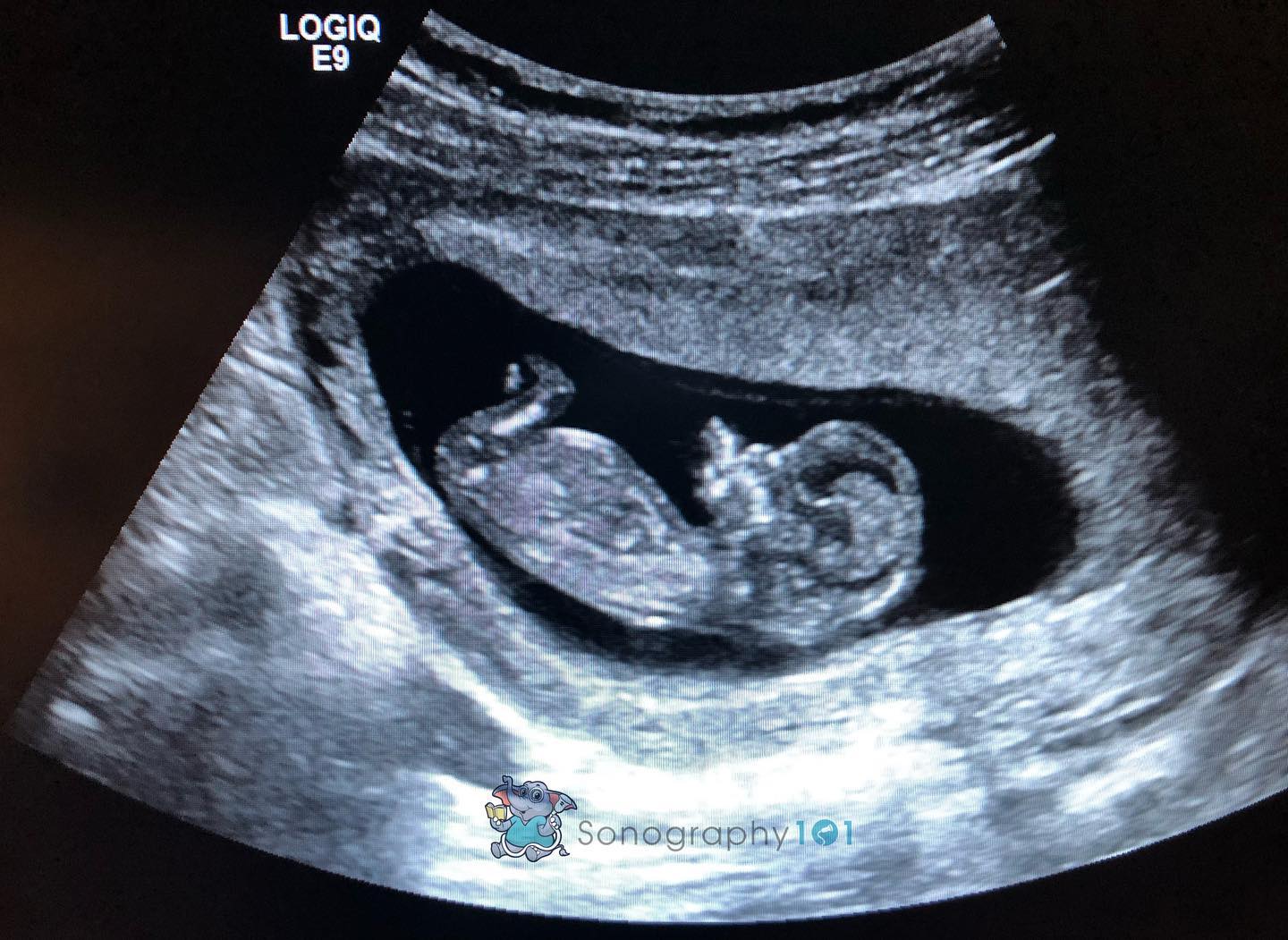 We are thinking of each and every single one of you during these extremely hard weeks, and those that are yet to come. 😕
We are thinking of all the mommies to be that have to experience the most beautiful and terrifying moments of motherhood away from their families and significant others. 😔
But, remember we can get through this like the warriors we are 💪🏻🙏🏻😁