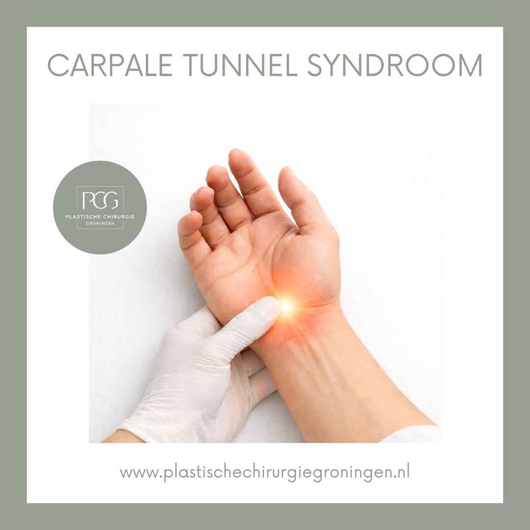 Tintelingen, pijn of een doof gevoel in je hand? 🤲⚡
Dit kan wijzen op het carpale tunnel syndroom (CTS): een beknelling van de zenuw in de pols.
Wanneer klachten blijven aanhouden, kan een carpale tunnel operatie helpen om de druk op de zenuw te verminderen en klachten te verlichten.
Herken je deze symptomen? Neem gerust contact met ons op voor advies. 💬