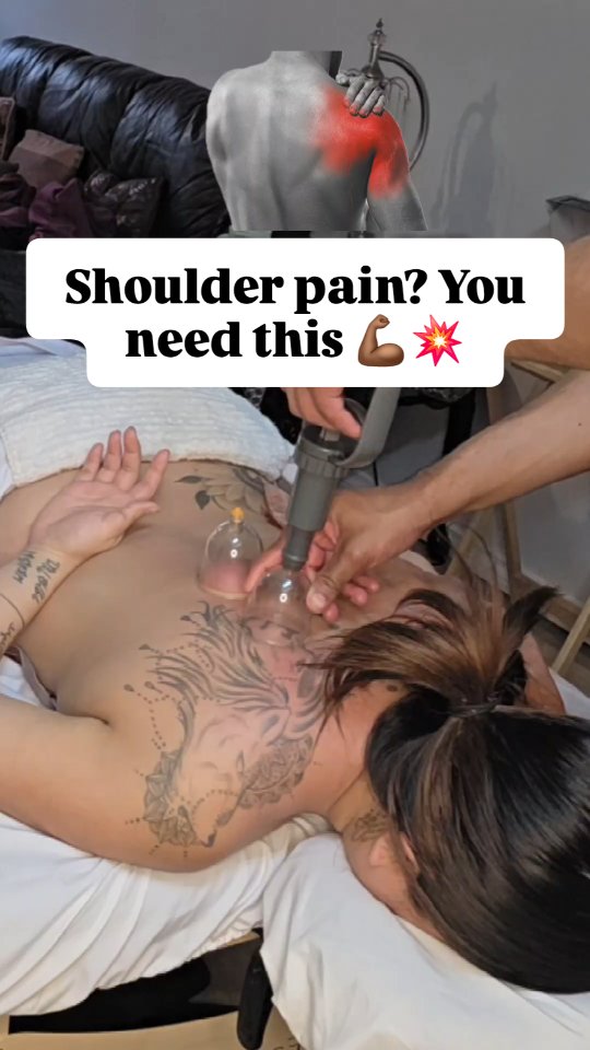 Shoulder pain or tightness during workouts or daily activity?
Your rotator cuff muscles work hard to stabilize the shoulder. When they get tight or overworked, it can lead to pain, stiffness, and limited movement.
Cupping therapy helps decompress the tissue and increase circulation in these areas to help relieve tension and improve mobility.
Save this for your next recovery day.
#massagetherapist #massage #massagetherapy #Calgary #yyc