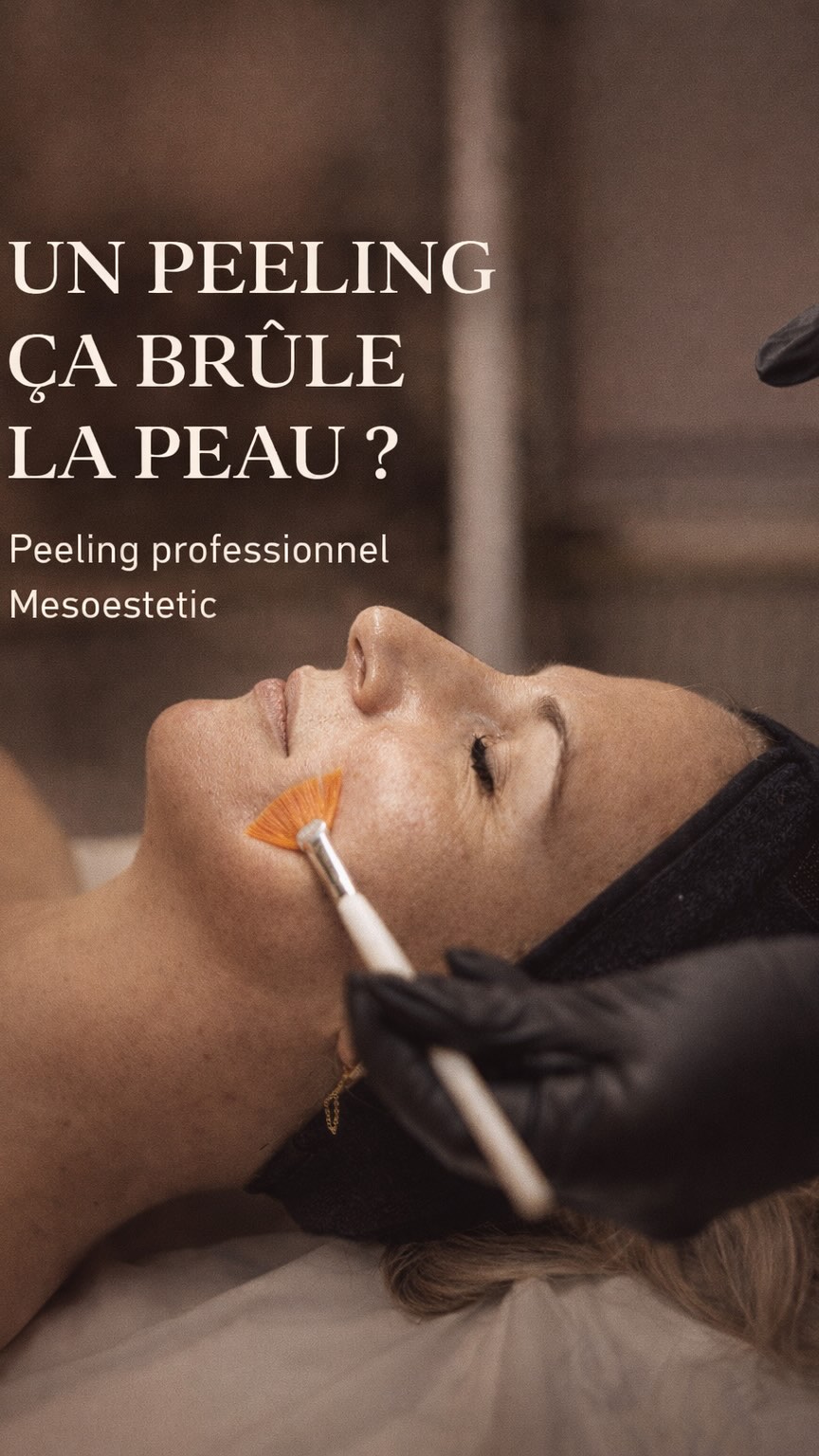 ✨ “Un peeling, ça brûle la peau ?”
C’est une question que j’entends très souvent au cabinet.
Les peelings que je réalise sont des peelings professionnels Mesoestetic, une référence reconnue en médecine esthétique.
Il s’agit de peelings superficiels et progressifs :
le but n’est pas d’agresser la peau, mais de stimuler en douceur le renouvellement cellulaire.
Résultat au fil des séances :
✔️ peau plus lumineuse
✔️ grain de peau affiné
✔️ imperfections et taches atténuées
✔️ teint plus uniforme
Pour un vrai travail de peau, on recommande un protocole de 6 séances, espacées de quelques semaines.
📸 Les photos permettent de suivre l’évolution et observer les résultats au fil du protocole.
Les soins sont réalisés par une infirmière formée aux protocoles Mesoestetic, pour un accompagnement sûr et adapté à chaque peau.
La peau ne se brutalise pas.
Elle se transforme progressivement.
📍Elite Skin – Cambrai
Réservation sur Planity ou au 06.73.16.65.01
#peeling #antiage #cambrai #peauparfaite