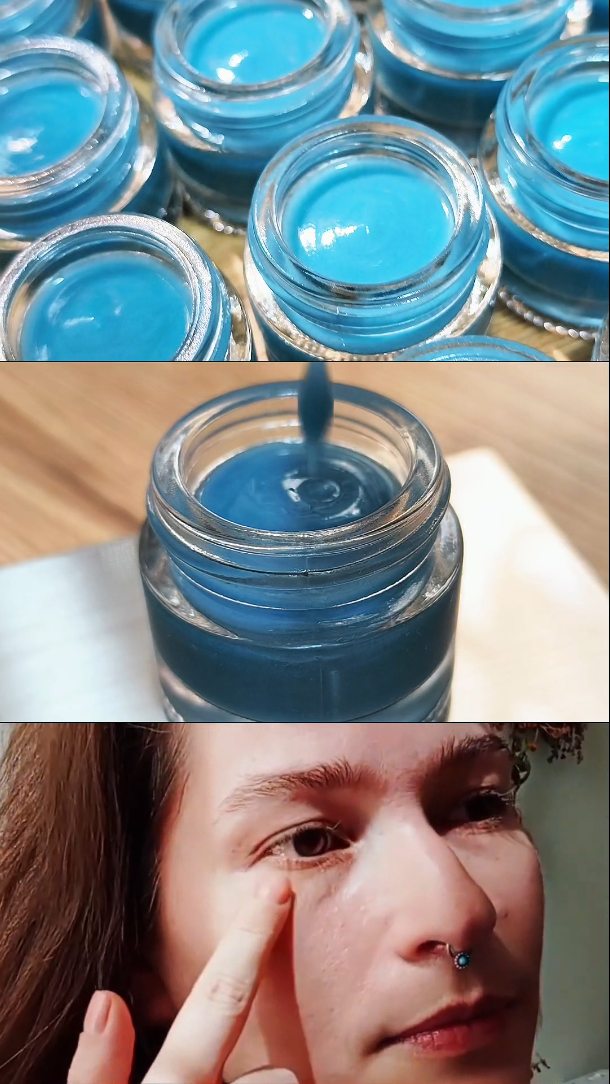 ✨ Blue Magic — Contorno de Ojos ✨
La piel del contorno de ojos es una de las más delicadas del rostro, por eso formulamos Blue Magic con ingredientes botánicos cuidadosamente seleccionados para hidratar, calmar y ayudar a mantener esta zona luminosa y saludable.
Su característico tono azul proviene de dos aceites esenciales extraordinarios que trabajan en sinergia para cuidar esta área tan sensible.
Ingredientes estrella ⭐
⭐ Tanaceto azul (Blue Tansy)
Potente antiinflamatorio y antioxidante. Ayuda a reducir la inflamación, las rojeces y protege la piel del estrés oxidativo, uno de los principales responsables del envejecimiento prematuro.
⭐ Manzanilla azul
Conocida por sus propiedades calmantes y reparadoras. Ayuda a aliviar la irritación, disminuir la hinchazón y aporta confort a la piel delicada del contorno de ojos.
⭐ Ácido hialurónico de bajo peso molecular
Hidrata profundamente, mejora la elasticidad de la piel y ayuda a suavizar la apariencia de líneas de expresión.
⭐ Alantoína
Ingrediente reconocido por sus propiedades calmantes y regeneradoras. Favorece la reparación de la piel, suaviza y contribuye a mantener el contorno de ojos más uniforme.
💙 Blue Magic es un cuidado delicado pensado para hidratar, calmar y acompañar la piel del contorno de ojos día tras día.
#contornodeojos #cosmeticanatural #natural #organico #artesanal