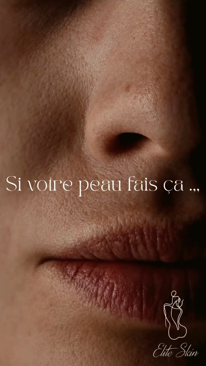 Si votre peau fait ça… elle est probablement déshydratée.
Beaucoup de personnes pensent avoir la peau sèche, alors qu’en réalité leur peau manque simplement d’eau.
Certains signes ne trompent pas :
• teint terne
• ridules plus visibles
• sensation de tiraillement
• maquillage qui marque
• pores plus apparents
La déshydratation peut toucher tous les types de peau, même les peaux mixtes ou grasses.
Mais un autre facteur entre souvent en jeu : le ralentissement du renouvellement cellulaire.
Quand les cellules mortes s’accumulent à la surface de la peau, les soins hydratants pénètrent moins bien et la peau perd en éclat.
C’est pourquoi l’association de soins hydratants profonds comme l’Hydractive et de peelings professionnels permet de :
✨ stimuler le renouvellement cellulaire
✨ améliorer la pénétration des actifs
✨ retrouver une peau plus lumineuse et plus lisse
Résultat : une peau plus fraîche, plus éclatante et mieux hydratée. #soinvisage #peeling #hydrafaci̇al #hydratation #skinglow