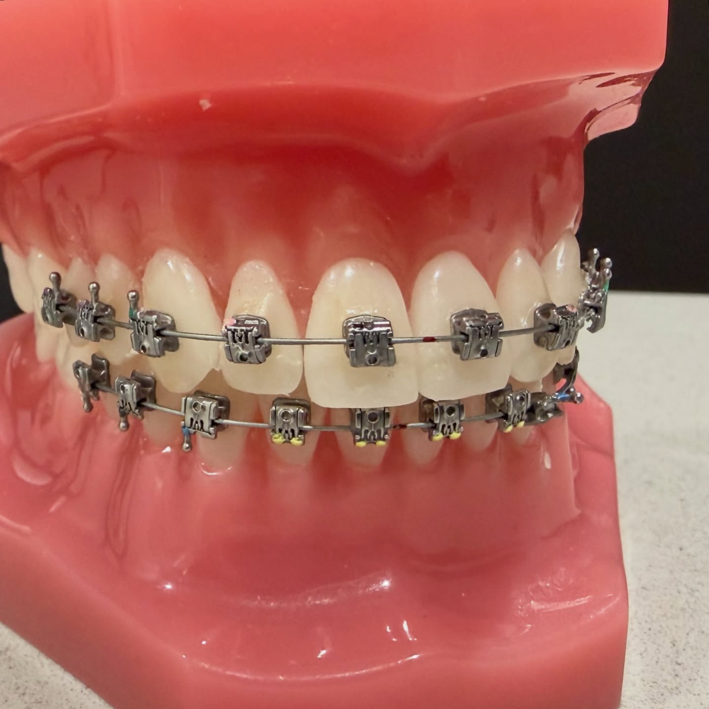 Have you ever thought about straightening your teeth?
Braces aren’t just about looks—they can improve your bite, oral health, and confidence too.
Book an orthodontic consultation at Red Rock Dental and see what’s possible for your smile!
📞403-905-0522
.
.
.
#redrockdental #medicinehatdentist #medicinehatorthodontics #yxhdentist #orthodontictreatment