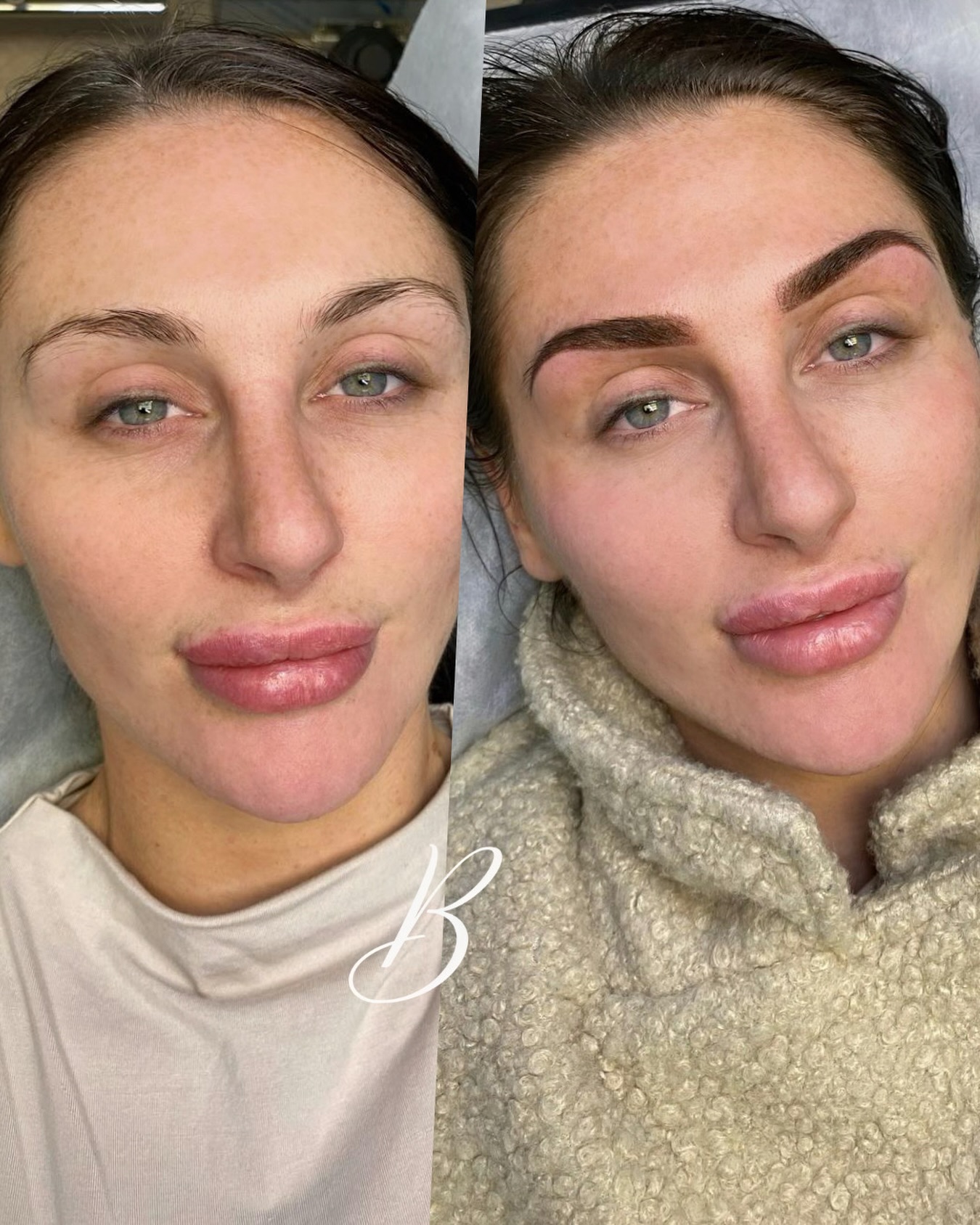 Tired of filling in your brows every single day? ⏰
Powder Brows are perfect for busy women, moms, and professionals who want to wake up with flawless brows without spending time in front of the mirror.
Imagine saving minutes every morning and looking put-together the moment you wake up, without makeup smudging. ✨
Book your appointment today through the link in my bio. 💫
#powderbrows #browscardiff #spmucardiff #pmuuk #beautycardiff