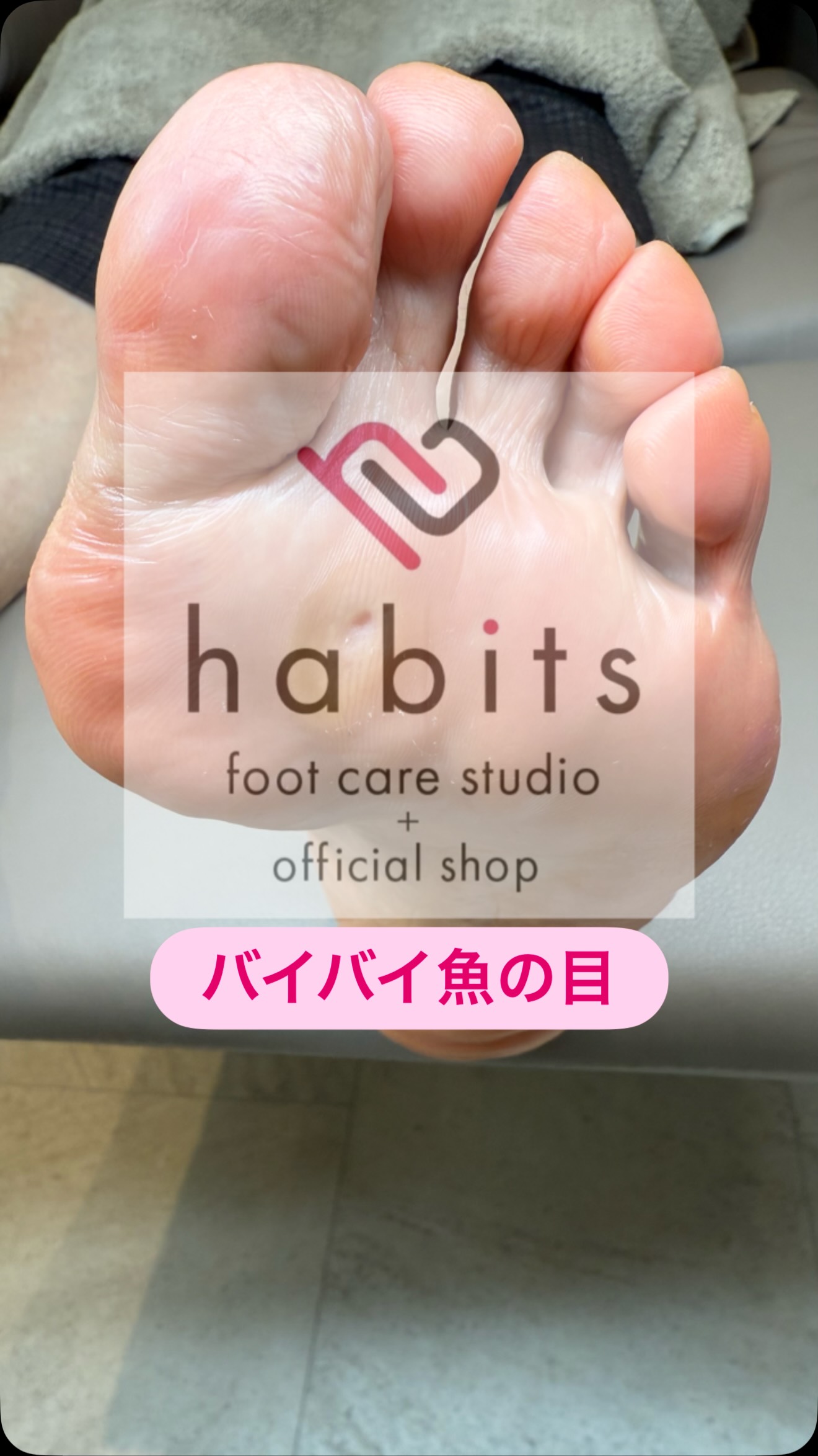 魚の目の痛みとGoodBye👋
━━━━━━━━━━━━━━