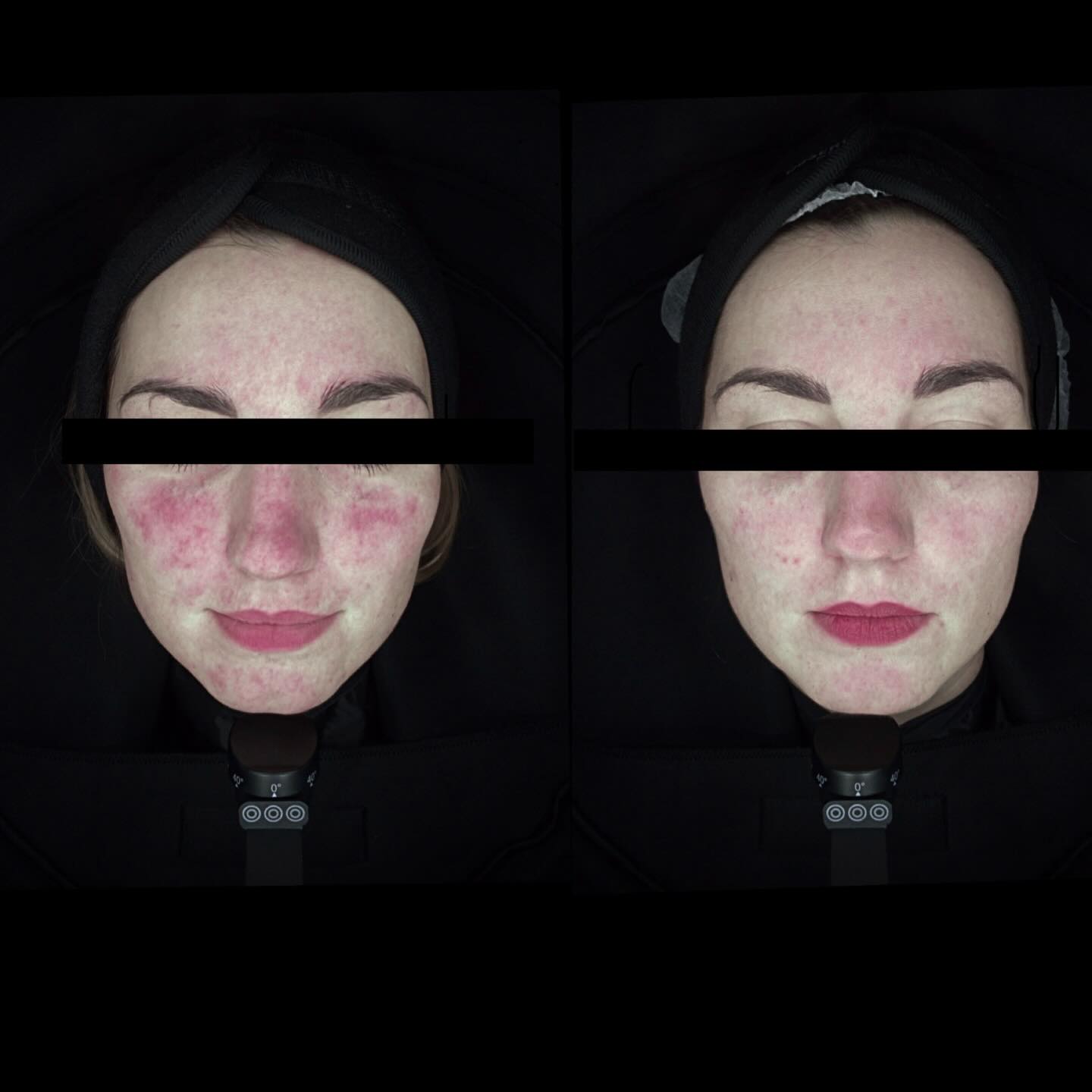 Światło szerokopasmowe ✨