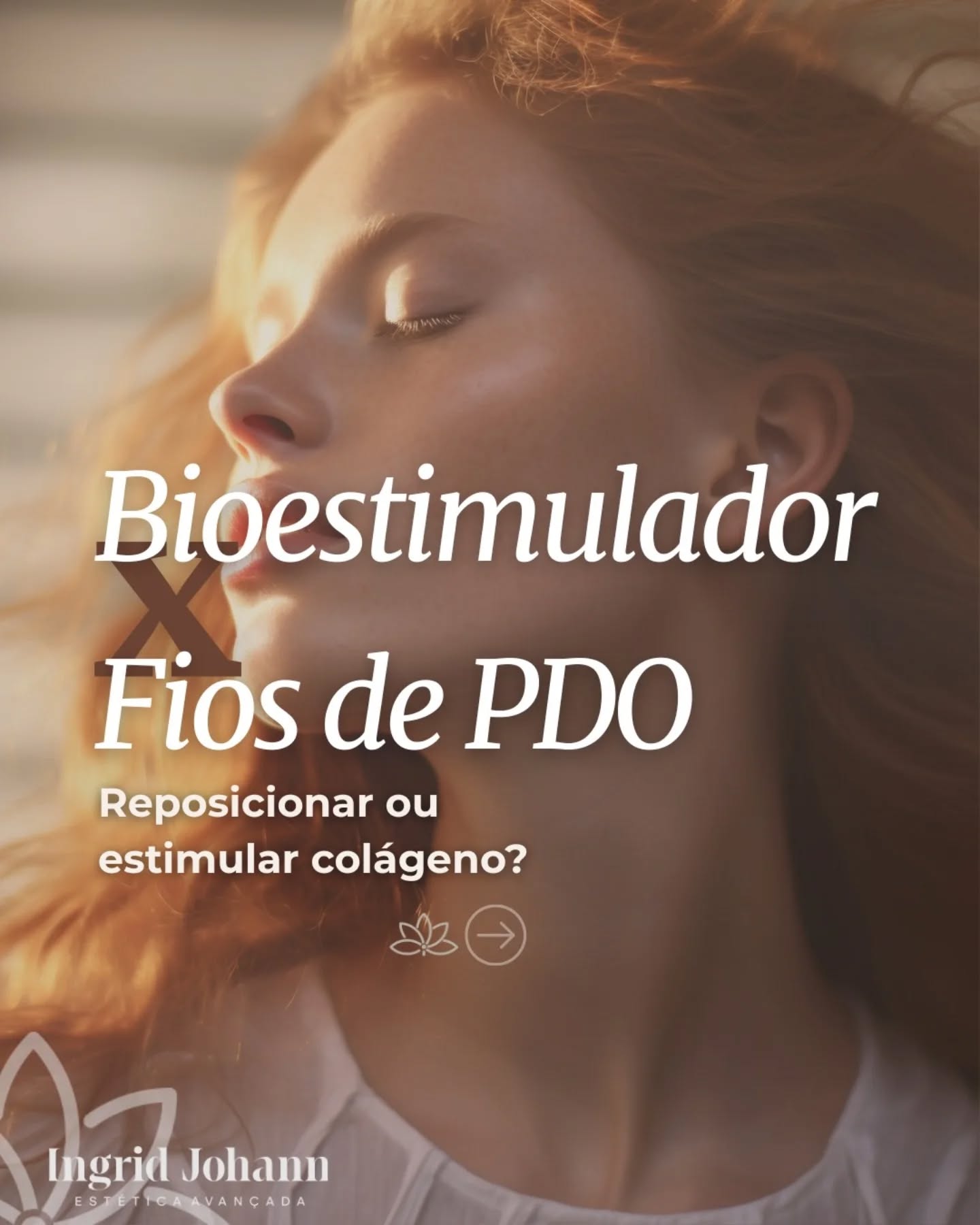 Fios reposicionam.
Bioestimulador estimula colágeno.
Não são concorrentes, são estratégias diferentes.
Enquanto os fios promovem sustentação e efeito lifting, o bioestimulador melhora a qualidade da pele de dentro para fora.
✨ E em muitos casos, a associação das técnicas potencializa o resultado.
Cada rosto tem uma necessidade.
Cada plano é individualizado.
📍 Agende sua avaliação.
#fiospdo #bioestimulador #colageno #harmonizaçãofacial #esteticaavancada