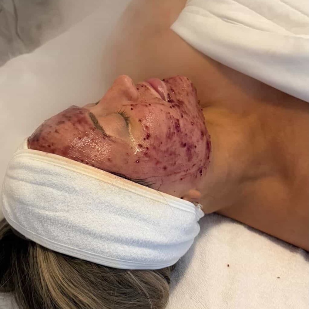 Investing in your skin is a marathon, not a sprint. Take the first step
brought to you by @aestheticsbyilyana ☁️