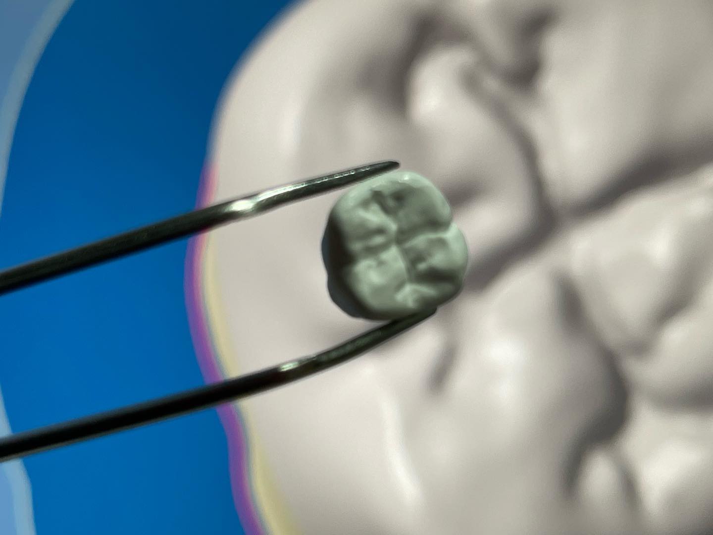 Lo más impresionante es ver cómo todo aquello que primero está está en tu imaginación, y luego en la pantalla, termina en tus manos 🔻
🔻
🔻
🔻
🔻
⭐️ Hoy día es una realidad! nuestra nueva tecnología para rehabilitación oral mediante flujo de trabajo digital: escaneo intraoral, diseño digital de restauración, y creación Robotizada, mediante fresado e impresión 3D de coronas y PPF en zirconio, incrustaciones en zirconio o ceromeros, entre muchas otras opciones de rehabilitación
🔻
🔻
#implandent #formlabs #dralinaquintero #rehabilitacionoral #odontologiaarmenia #rehabilitacionoralarmenia #implantesdentalesarmenia #odontologia3d #odontologiaestética #armeniaquindio #esteticadental #shining3d #OdontologiaCADCAM #odontologíadealtacomplejidad #DrHectorAndresQuintero #Dentistrylove #Dentistrylife #Odontologiadigital