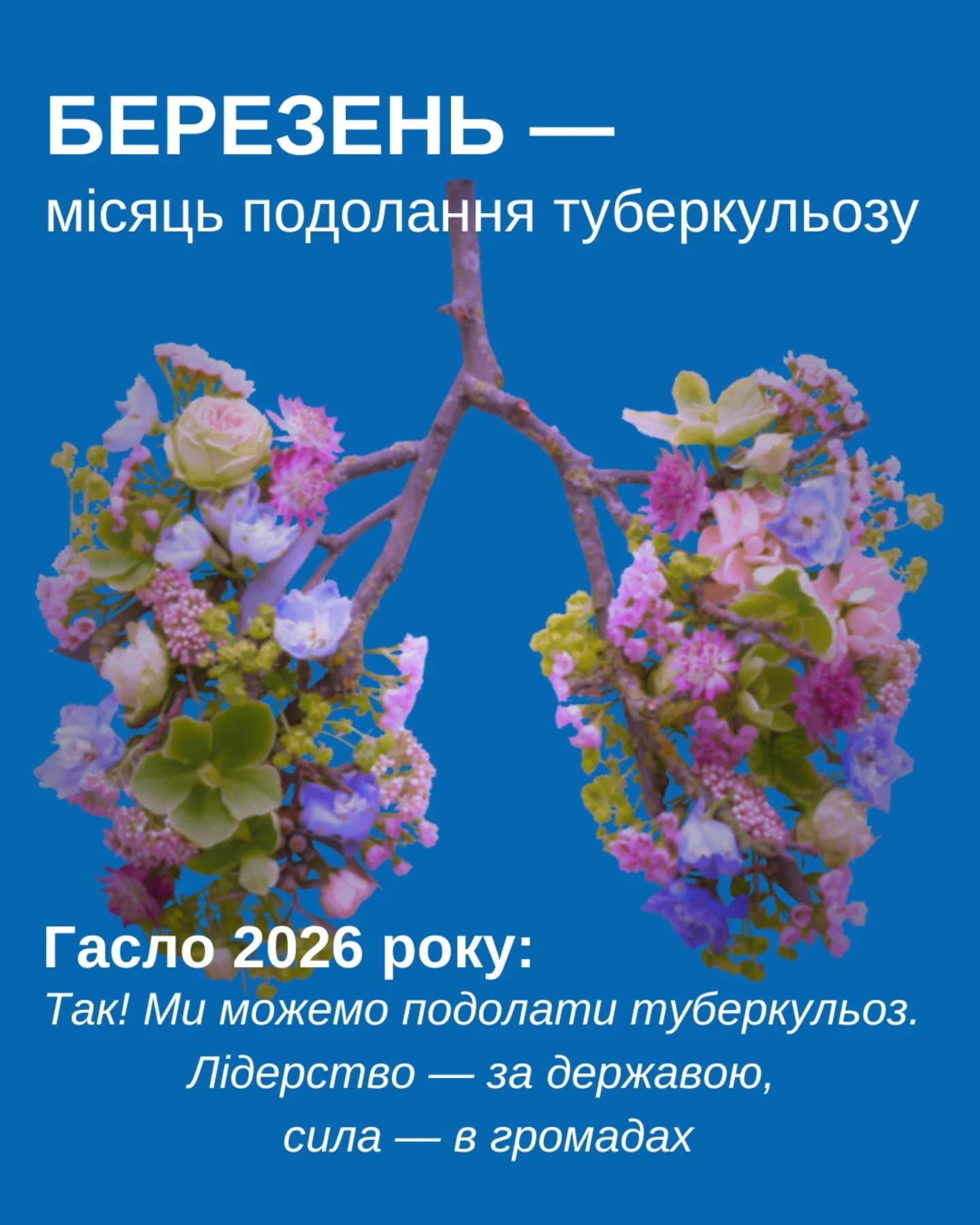 🌿 Березень - місяць подолання туберкульозу!
❗️Туберкульоз є одним із найпоширеніших інфекційних захворювань у світі. Він є підступною хворобою, оскільки може застати людину будь-де.
🩻 Захворіти може кожен. Наша задача - вчасно виявити хворобу та застосувати сучасні ефективні методи лікування.
💙 Попередити розповсюдження туберкульозу можна за допомогою ультрафіолету. Бактерицидні екрановані опромінювачі UV-BLAZE допоможуть перервати повітряні шляхи передачі, а також інших інфекційних захворювань.
🎁 Дізнатися більше та замовити на сайті UV-BLAZE (в шапці профілю)
✉️Пишіть нам в Direct або звертайтесь за телефонами:
📞+380688772166,
+380631541925,
+380660366110
Джерело: Сайт ЦГЗ МОЗ України
#uvblaze #туберкульоз #ультрафіолет