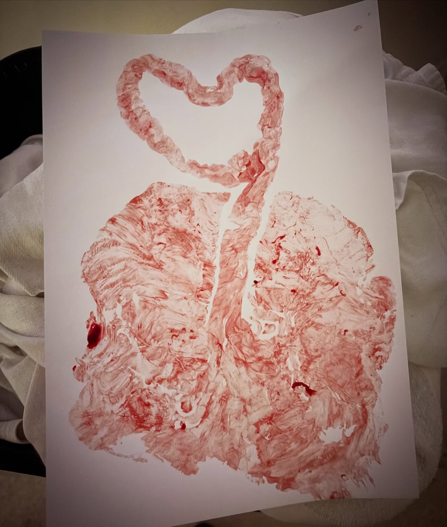 Hi, my name’s Beth and I’m obsessed with your placenta.
I am a placenta hype girl.
I will hype that organ up like it just ran a marathon and built a life-support system at the same time.
Like excuse me?! You grew an entire temporary organ that kept a human alive for nine months?
Iconic.
Legendary.
Honestly underappreciated.
That placenta said:
“I’ll handle oxygen, nutrients, hormones, waste removal, AND immune diplomacy.”
Round of applause for the placenta.
No notes. 10/10 performance 👏
I’ve just started offering placenta prints along with birth support. Done in the hours after you’ve birthed and ready to admire just as much as your bebè (ok maybe not. *Nearly* as much?!).
#placentaart #placentaprint #doula #birthdoula #mebournedoula