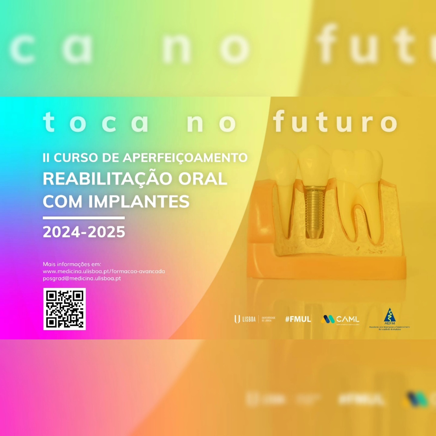 Formação de futuros Líderes da Implantologia!
A Faculdade de Medicina da Universidade de Lisboa apresenta o II Curso de Aperfeiçoamento em Reabilitação Oral com Implantes, uma oportunidade única para dominares técnicas avançadas e elevares a tua prática clínica ao próximo nível.
💡 O que este curso te oferece?
Competências Clínicas Avançadas: Aprende a gerir casos desde os mais simples aos mais desafiantes, como reabilitações em situações de atrofia maxilar severa ou com elevada exigência estética.
Formação Prática de Excelência: Domina todas as etapas da reabilitação oral, com enfoque no planeamento cirúrgico guiado pela reabilitação, biomecânica e princípios da oclusão.
Atualização Profissional: Fica a par das mais recentes práticas e tecnologias na implantologia moderna.
📸 Casos Reais de Sucesso: Confere os casos clínicos avançados, realizados e documentados por alunos da edição anterior, que provaram a eficácia dos conhecimentos adquiridos em ambiente hospitalar.
📅 Calendário:
Candidaturas: De 26 de dezembro de 2024 a 16 de janeiro de 2025.
Seleção de Candidatos: De 16 a 18 de janeiro de 2025.
Inscrições: De 18 a 21 de janeiro de 2025.
Duração do Curso: De 24 de janeiro a 14 de julho de 2025.
💰 Propinas:
Valor total: 8.000€.
📍 Local: Aulas em regime misto, presenciais (FMUL, ULS Santa Maria e ULS Lisboa Ocidental) e via Zoom.
🚀 Eleva a tua prática clínica e destaca-te na área da reabilitação oral com implantes!
🔗 Sabe mais e inscreve-te aqui: https://www.medicina.ulisboa.pt/curso-pos-graduado-reabilitacao-oral-com-implantes.
💼 Investe na tua carreira e torna-te uma referência na área!