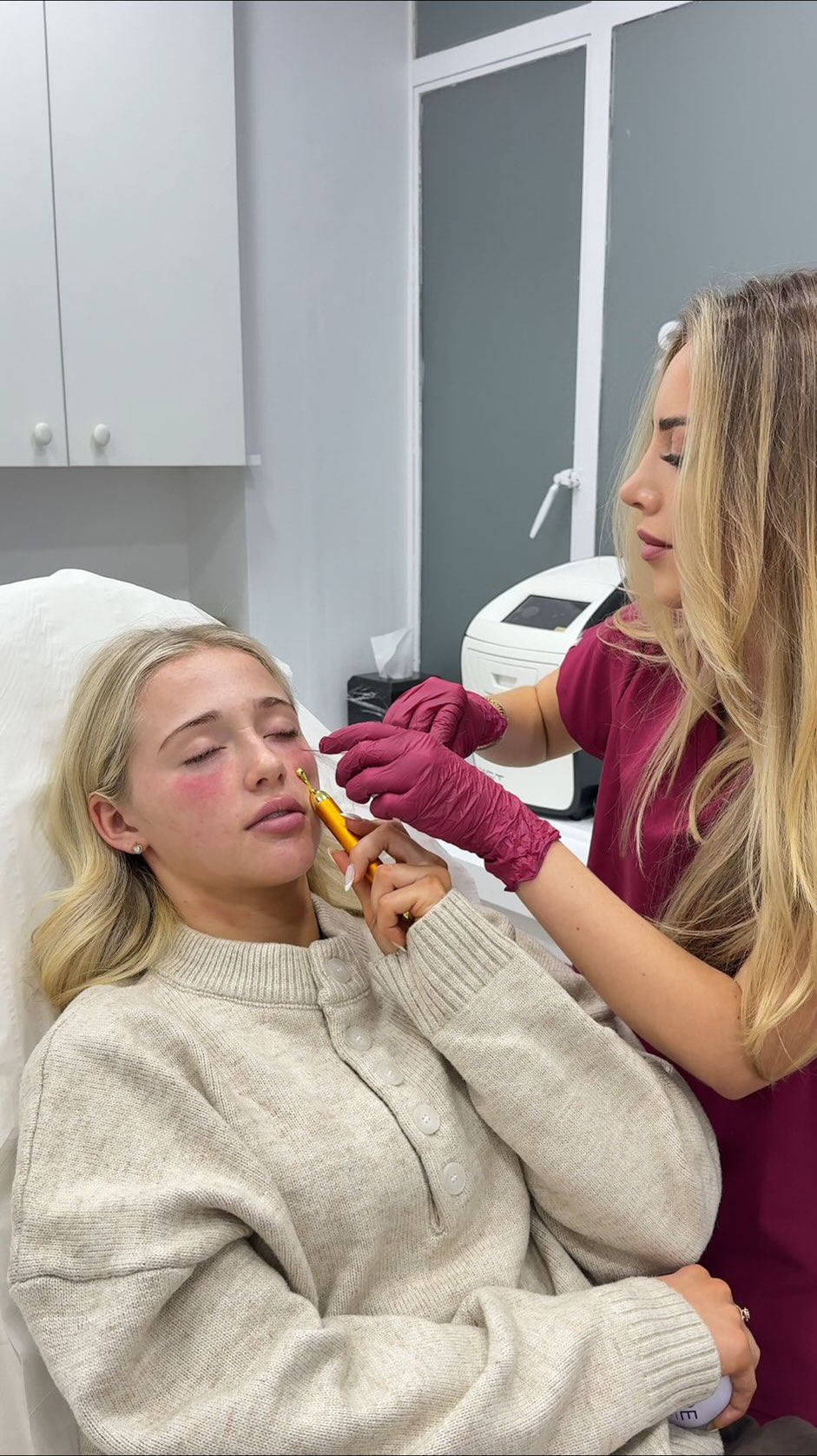 IT girl treatments 💉
It’s about subtle, thoughtful enhancements that help you look and feel like the best version of yourself ❤️
Polynucleotides take a regenerative approach to the under-eye area. Rather than adding volume like filler, they work to improve skin quality and support collagen production. This makes them a gentler option for younger patients where the concern is often skin quality improvement, rather than volume loss.
#aesthetics #oliviaebbaaesthetics #polynucleotides #naturalaesthetics #trendingreels