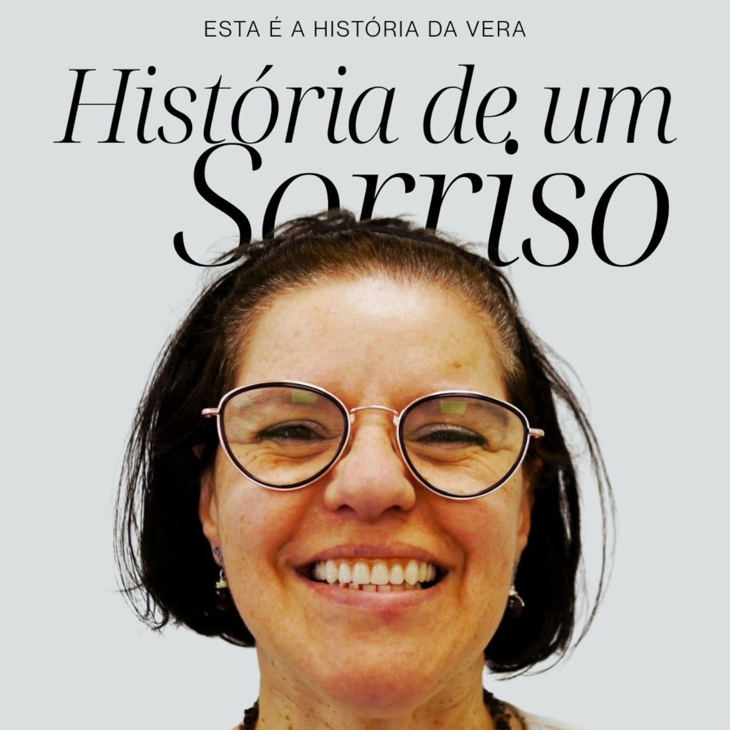 Cada sorriso é único. ✨️
Cada sorriso tem uma história.
Esta é a história do sorriso da Vera.
✨️
Por causa de um defeito de crescimento dos maxilares nunca gostou da aparência da sua face.
Este problema também levou à perda precoce de vários dentes.
Quando chegou até nós a Vera já não acreditava que o seu caso tivesse solução.
Hoje a Vera é uma pessoa diferente, mais confiante, com mais auto-estima e mais sorridente 😁
