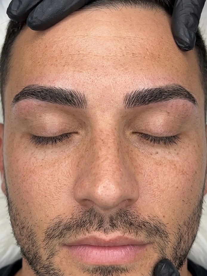 Men get **microblading** too—and it’s not “makeup.” It’s a cleaner frame for your face. 🤝🤎
If your brows are:
- patchy or sparse
- uneven from over-plucking/scars
- disappearing in photos 😩📸
Microblading (hair-like strokes) can bring them back in a way that still looks **natural**—like you just have good brows, period. ✍️
No blocky brows. No “done” look. Just subtle structure. ✅
DM **“BROW”** + your skin type (oily/dry/normal) + your goal (natural/more defined) and I’ll tell you if microblading is the best brow tattoo option for you + send booking info. 📩
📍Luna Beauty Studio — Richmond Hill (The Clinica)
#mensgrooming #mensbrows #microbladingmen #mensmicroblading #browtattoo