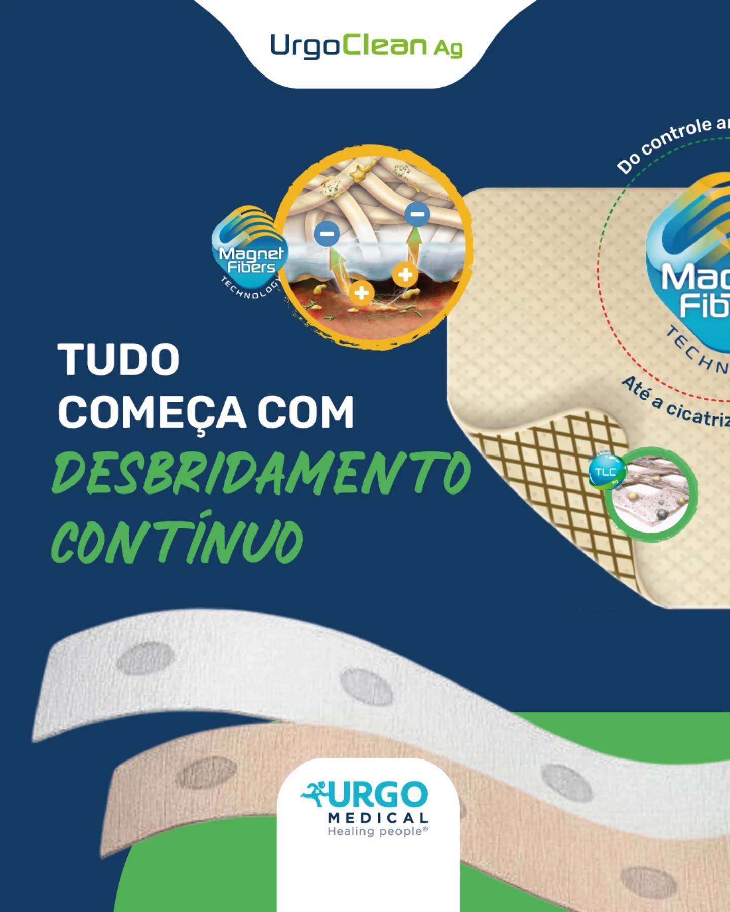 UrgoClean AG combina desbridamento contínuo pelas Fibras Magnéticas com a ação antimicrobiana da TLC-Ag para remover as barreiras da cicatrização.
Conheça nossa solução e otimize seus resultados no cuidado com lesões.
