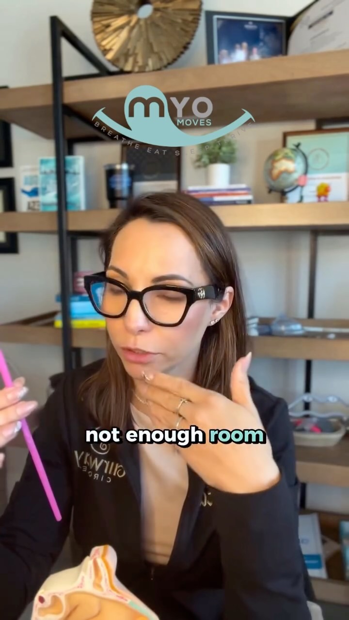 A large airway while you’re awake doesn’t always mean a clear airway when you sleep.
When we fall asleep, muscles relax and if the tongue doesn’t have enough room to rest up and forward, it can fall back and narrow the airway. Even if the airway looks “big” during the day. This is why airway issues aren’t just about nasal breathing or tongue posture alone.
Jaw position, tongue space, and muscle function all matter. When the jaws sit too far back, the tongue has nowhere to go… except back.
That’s where myofunctional therapy, airway-focused orthodontics, and proper diagnosis come into play — because treating the root cause matters more than chasing symptoms.
If this just connected some dots for you, drop MYO in the comments. 👇
#airwayhealth #myofunctionaltherapy #sleepdisorderedbreathing #mouthbreathing #jawdevelopment