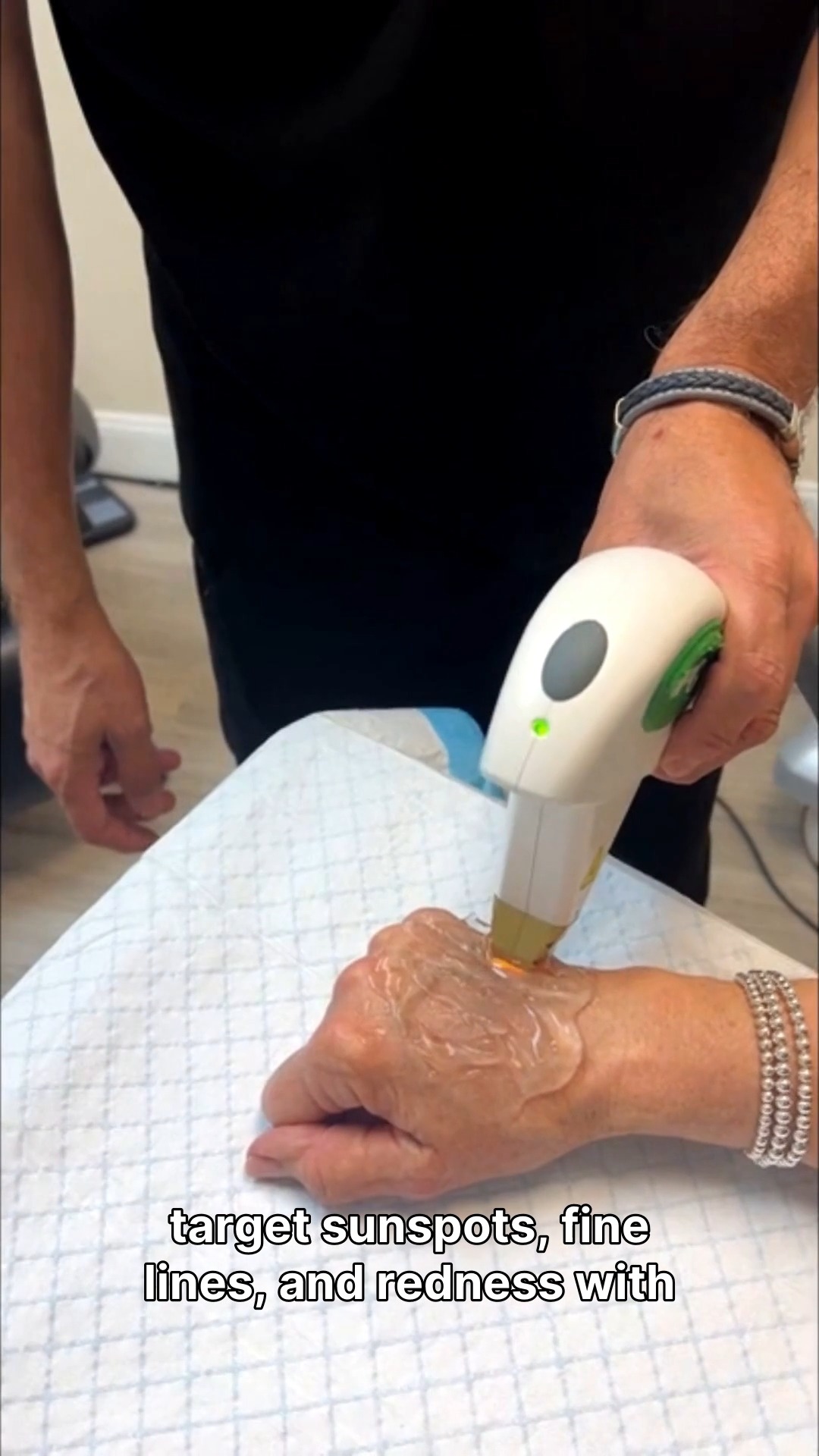 Clearer skin for a new season. ✨
Living in Central Florida means we enjoy the sun year-round, but your skin doesn't have to show it. Dr. Samano uses IPL (Intense Pulsed Light) to target the deeper layers of the skin, gently lifting away damage and restoring your natural clarity.
Whether you’re looking to soften fine lines or erase years of sunspots, our goal is always the same: to help you look refreshed, not redone.
Special March Rates:
✨ One Treatment: $250
✨ Package of Three: $750
Targets:
🎯 Sunspots and Pigmentation
🎯 Fine Lines
🎯 Broken Blood Vessels
🎯 Rosacea
Ready to reclaim your glow? 🌿 Call us today at 407-790-4020 to book your appointment or schedule a consultation at our Winter Park office.
#SamanoAesthetics #WinterParkFL #OrlandoBeauty #IPLPhotofacial #SkinRejuvenation #CentralFloridaMedSpa #RefreshedNotRedone