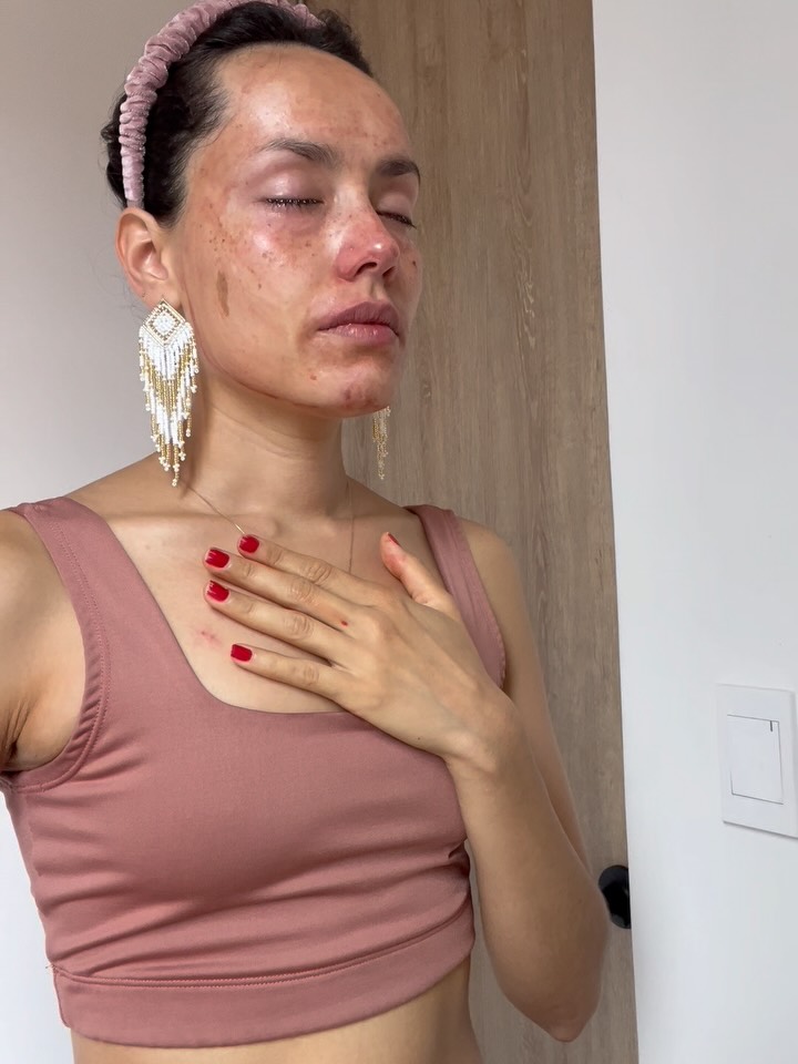 No soy la mujer que conociste hace dos años.
Ni la de hace cinco o diez años.
Ni la que conociste ayer.
He crecido, me he transformado, he aprendido.
Desde que llegué a Colombia hace ya dos años he sangrado 27 veces. Unas han sido dolorosas, otras amorosas. Son 27 muertes y 27 renacimientos. En este tiempo mi vida ha cambiado completamente: mi cuerpo, mis creencias; se han ido personas que amo y han llegado otras. He reconectado con viejas amistades y se han abierto portales que no sabía que existían.
He gestado proyectos, me he dado a luz una y otra vez en diferentes aspectos de mi vida. He habitado duelos, tristezas, alegrías y vacíos. He ganado y, sobre todo, he aprendido.
Esta sangre que ven representa la muerte de una parte de mí; un ciclo que finalmente se cierra. Mueren creencias, expectativas y memorias viejas que seguía cargando en mi cuerpo. Ayer, finalmente, lo pude comprender y encarnar.
Hoy mi útero ha vaciado fantasmas que ocupaban espacio desde hace años.
Entro a un nuevo ciclo. Es algo que se siente en los huesos, en el pecho, en el corazón, no se puede explicar con palabras; se siente como un despertar. Sé que hoy empieza una nueva versión de mí.
Gracias vida. Honro mi sangre, que me recuerda que las partes que ya no soy se despiden. La sembré, la devolví a la tierra, me liberé y liberé todo aquello que estaba reteniendo.
Y en medio de este morir y renacer, ocurrió algo simbólico y aterrador para nuestra mirada humana: anoche, 13 de marzo de 2026, a Río lo atropelló una moto.
Vi la muerte frente a mis ojos y, en el mismo instante, vi la vida renaciendo. Gracias Dios, nuestro Río está bien, sin ninguna lesión grave. Solo quedamos con el shock en nuestro sistema nervioso por experimentar el fin y el inicio en cuestión de horas.
Hoy habito un cuerpo nuevo.
Y sé que, al igual que yo, tú también has muerto muchas veces en silencio para poder estar aquí hoy.
Gracias por estar aquí y presenciar este renacimiento.🙌🏼💙
✨Maga Celeste