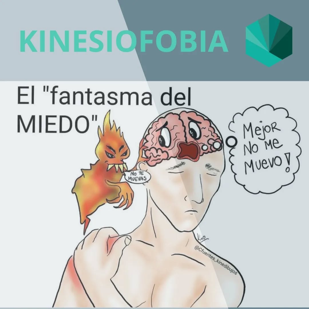 Hola! 👋🏼
Hoy venimos a hablaros sobre la KINESIOFOBIA
¿Y esto que es? 🤔
Pues bien, la kinesiofobia se define como el miedo irracional y debilitante al movimiento y la actividad física, derivado de las creencias de vulnerabilidad y susceptibilidad a la lesión.
Son muchos los factores los que pueden llevar a una persona a desarrollar miedo al movimiento, entre ellos: una mala información por parte del personal sanitario acerca de la lesión, un dolor que se prolonga en el tiempo afectando a las actividades de la vida diaria, laboral o incluso a las relaciones sociales, experiencias previas, falta de confianza en el cuerpo....
Sin embargo, está demostrado que la inactividad empeora notablemente la calidad de vida de las personas y el NO MOVIMIENTO no es la solución (excepto en casos muy puntuales).
El dolor es una sensación subjetiva y compleja en la que influyen numerosas vias neuronales, además de los estímulos físicos influyen las experiencias previas y los esquemas aprendidos de respuesta ante el dolor.
La inmovilización por evitación del dolor nos lleva a posiciones mantenidas que favorecen la rigidez articular y la limitación en la funcionalidad de una región, afectando a su vez a otras áreas que se ven obligadas a suplir la función de estas.
¿Cómo podemos superarlo? ❓
Siempre de las manos de un profesional que nos indique que actividades son adecuadas para cada momento de la lesión y nos acompañe en el proceso de manera individualizada.
Os dejamos el enlace de un artículo en el que ha participado un compañero por si queréis saber un poco más del tema!
https://www.sciencedirect.com/science/article/pii/S004871202400001X
Esperamos que os guste! ☺️