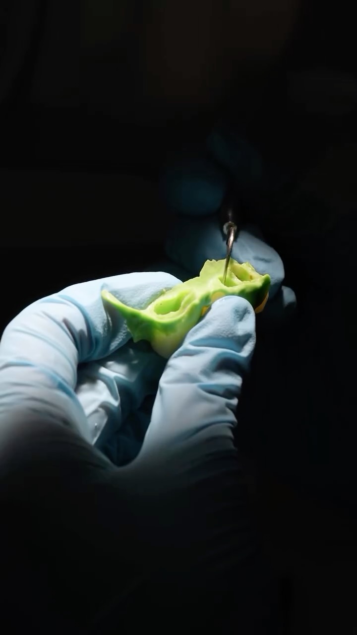 Our patient Kohls has achieved a healthy and beautifully aesthetic smile following a carefully planned treatment at Sirius Dental Clinic.
A natural, strong and confidence-boosting result.
If you are dreaming of a new smile, please feel free to get in touch with us.
#siriusdentalclinic #smileturkey #zirconium #implant #smiledesign