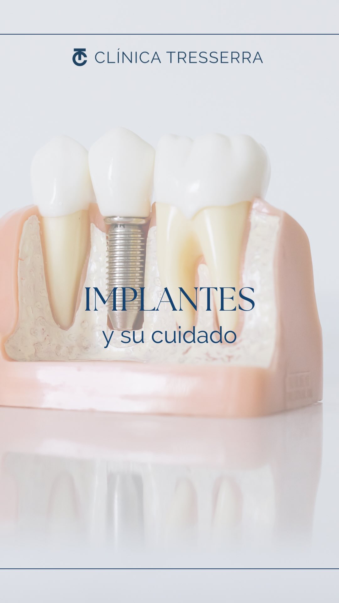🦷✨ ¿Tienes un implante o estás pensando en ponerte uno?
Estos son los cuidados clave para que dure muchos años 👇
✔️ Higiene diaria cuidadosa (cepillo + hilo dental o cepillos interdentales)
✔️ Limpiezas profesionales periódicas
✔️ Revisiones regulares con tu especialista
✔️ Evitar el tabaco (especialmente en los primeros meses)
✔️ Cuidar las encías tanto como el implante
Un implante no se puede “picar”…pero las encías y el hueso que lo rodean sí pueden enfermarse.
💬 ¿Sabías que el mantenimiento es clave para su éxito?
📩 Guarda o comparte este reel si conoces a alguien con implantes.
#ImplantesDentales #CuidadoDental #ClínicaTresserra #SaludBucal #DentistaBarcelona