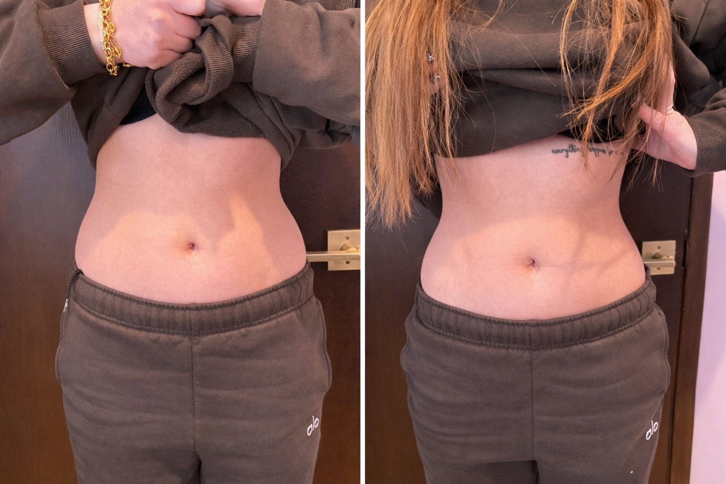 Abigon Body Contouring is designed to help sculpt and contour the body by targeting stubborn fat while tightening the skin. During the treatment, fat cells in the treated area are broken down and naturally eliminated by the body, meaning they do not regenerate in that same area. Many clients can see a reduction of 1–2 inches per session, along with improved skin firmness and smoother texture. This non-invasive treatment supports long-term body contouring with no downtime.
#body #bodytightening #summer #summertime #bodyfitness