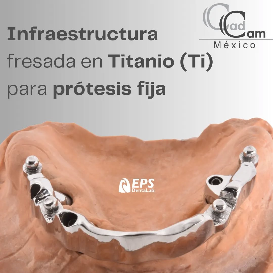 En nuestro compromiso constante con la excelencia, Cad Cam México te presenta nuestras infraestructuras de titanio fresadas con precisión, un avance revolucionario en la creación de prótesis fijas.
Imagina una sonrisa que no sólo deslumbra por su estética natural, sino que también está respaldada por la resistencia incomparable del Titanio. Con técnicas de cuerdas directamente fresadas para la prótesis, creamos la base perfecta para una prótesis fija que va más allá de las expectativas.
Nuestra tecnología de vanguardia garantiza no solo una adaptación perfecta, sino también una durabilidad excepcional. Confía en la innovación dental de Cad Cam México.
-
-
-
- - - Aviso de responsabilidad: Todas las fotos publicadas en esta cuenta de Instagram son propiedad intelectual de Estudio de Porcelana Suizo S.A de C.V. y están protegidas por derechos de autor.pin alvaro obregon 134 cuernavaca #CadCam #Mexico #Cromocobalto #implantologia #implantesdentales #dentistry #dentista