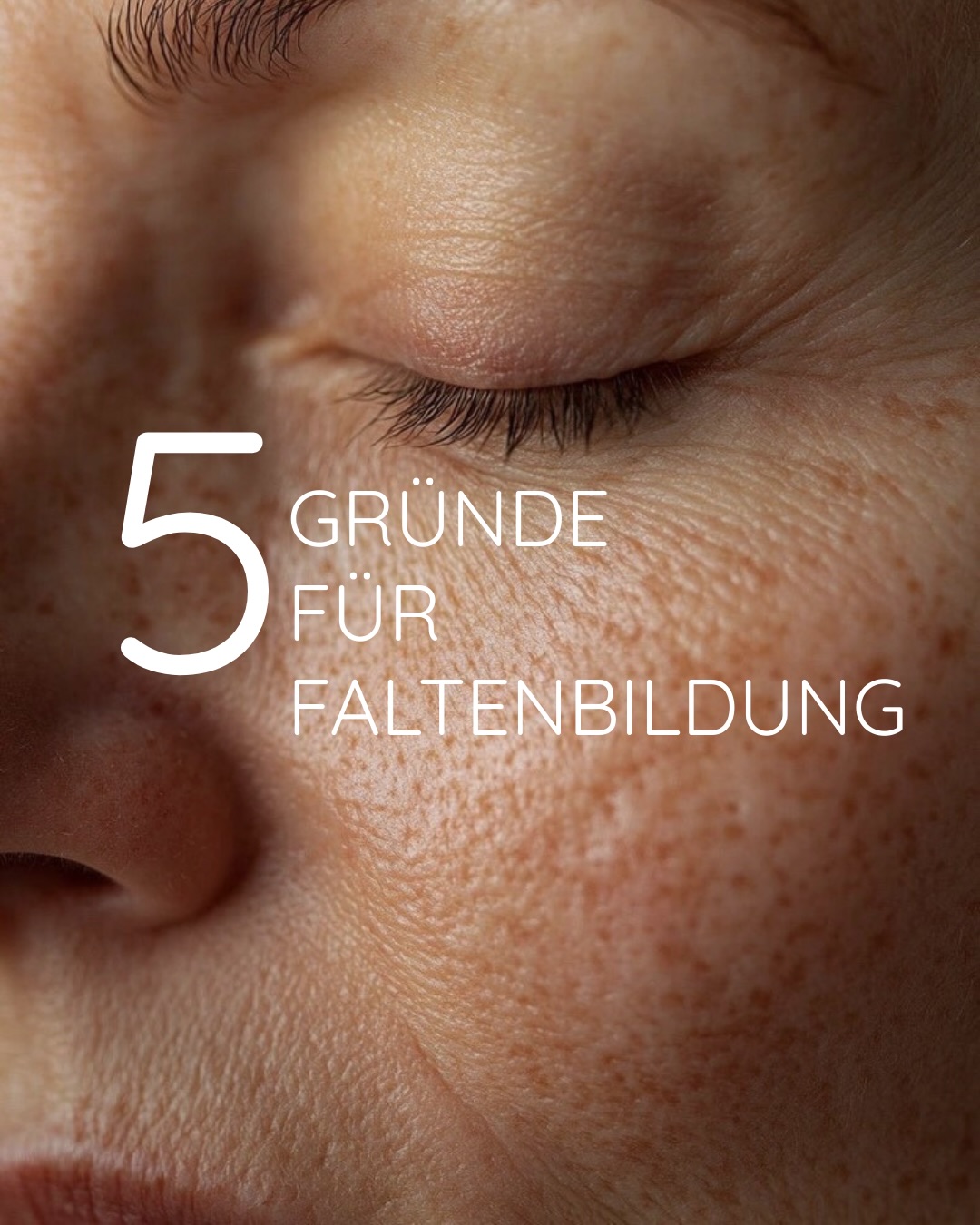 Warum haben wir Falten?👵🏼
Kollagenabbau, wiederkehrende Mimik, UV-Strahlung, Nikotin oder auch Feuchtigkeitsmangel – all das beeinflusst die Spannkraft unserer Haut und kann feine Linien und Falten entstehen lassen.
Bei NUA Aesthetics betrachten wir deine Haut ganzheitlich und setzen auf natürliche, harmonische Ergebnisse, die deine Ausstrahlung bewahren. 🤍
Buche jetzt deine persönliche Beratung und erfahre, welche Behandlung zu dir passt.
#nuaaesthetics #hautgesundheit #ästhetik #natürlichschön #falten