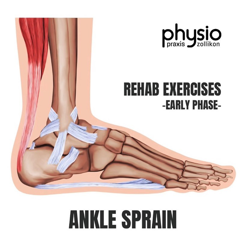 ‼️Ankle sprain rehab exercises - early phase ‼️
Ein Umknicktrauma (OSG-Distorsion) ist einer der häufigsten Verletzungen im Sport.
Hier seht ihr 8 Übungen in Progression, die dazu beitragen können die Mobilität und Stabilität des Sprunggelenks in der Früphase nach einem Umknicktrauma zu verbessern:
1️⃣ & 2️⃣: Mobilisierung des oberen Sprunggelenks um die volle Beweglichkeit wieder zu erreichen.
3️⃣ & 4️⃣: Beginn mit leichter Kräftigung der stabilisierenden Muskulatur mittels Theraband
5️⃣ & 6️⃣: zunehmende adaptierende Übungen mit dem Körpergewicht
7️⃣ & 8️⃣: dynamischen Stabilisierung auf festem Untergrund
Wir empfehlen bei den Übungen 2-3 Sätze, je 10-15 Wiederholungen, mit keinen Schmerzen bis leichte/moderate Schmerzen (die schnell verschwinden) während und nach der Übungsausführung.
Haftungsausschluss: Die Inhalte werden mit großer Sorgfalt ausgearbeitet, ersetzen jedoch keine individuelle fachliche Untersuchung und Behandlung durch einen Arzt oder Physiotherapeuten.
⚠️💪🏽 Möchtest du einen individuelleren Reha- oder
Trainingsplan um deine Ziele zu erreichen, vereinbare gerne einen Termin in unserer Praxis. Denn Link dazu findest du oben in der Bio auf unserem Profil.
#rehab #exercises #rehabilitation #osgdistorsion #anklesprain #anklemobility #stability #stabilitytraining #physiopraxiszollikon #health #physiotherapie #physio #physiotherapy #gesundheit #sport #training #fitness #therapie #physiotherapeut #physiolife #bewegung #moveyourbody #zollikon #zürich