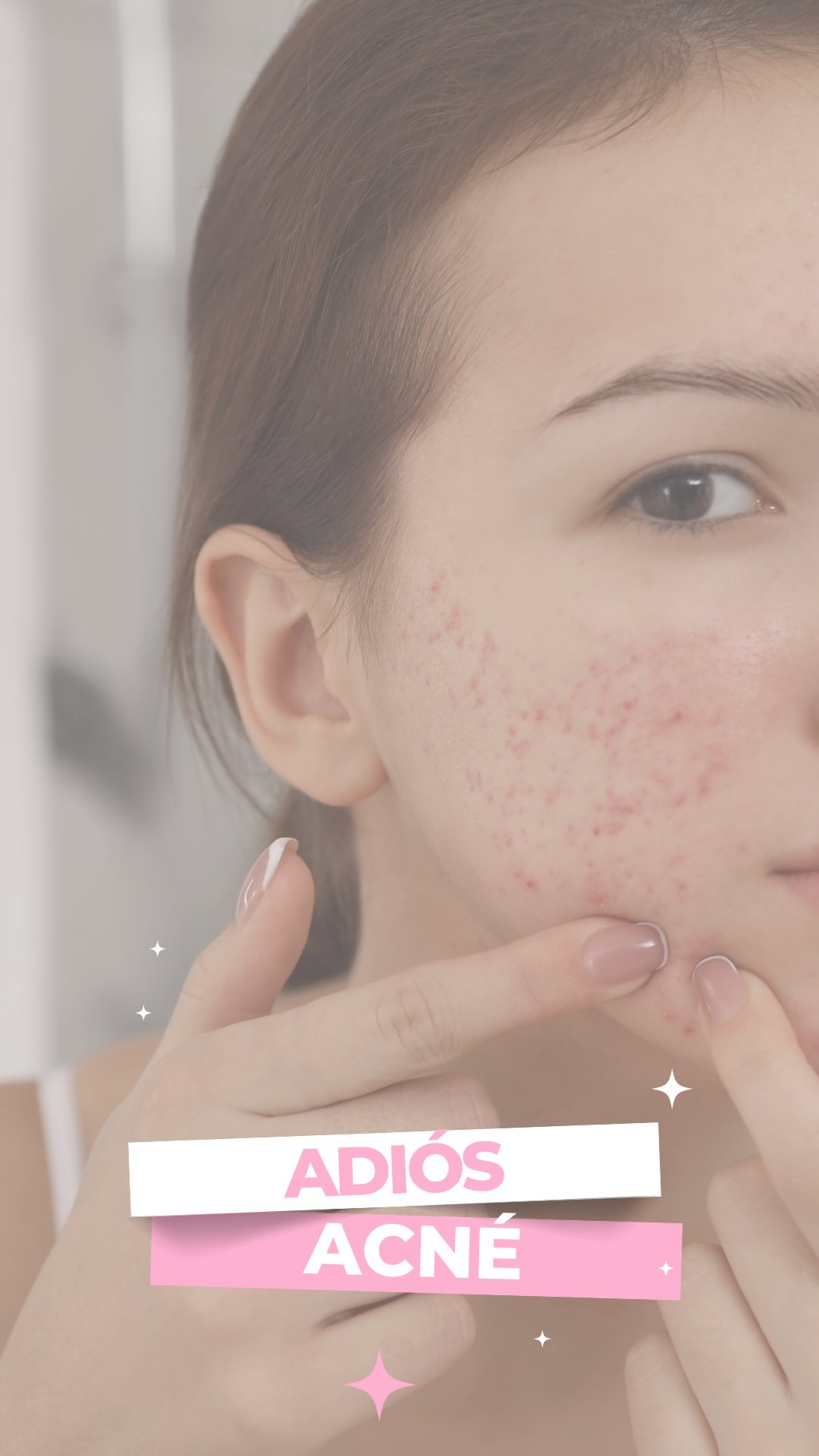 ¿Te preocupa el acné? ¿Te has hecho mil tratamientos y no te funcionan?
Empecemos por lo sencillo, por cuidar tu piel desde cero🌸
Tenemos tratamientos personalizados para cada tipo de piel,
te esperamos en Avenida Mirat, número 9, Salamanca 📍
#salamanca #belleza #facial #acne #acné