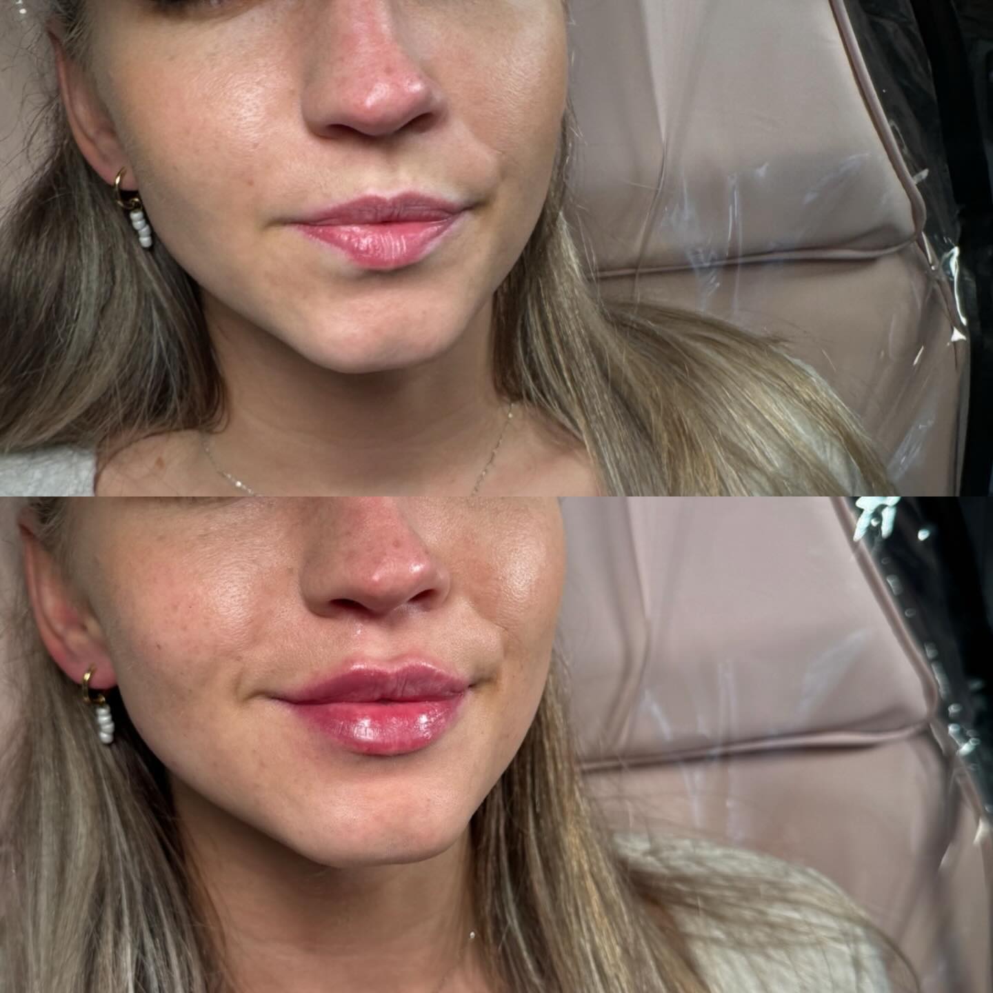 ⠀
A little tweak, a lot more confidence ✨✨
__________________________
Get in touch 👇🏽
𝐃𝐌 𝐔𝐒 𝐅𝐎𝐑 𝐄𝐍𝐐𝐔𝐈𝐑𝐈𝐄𝐒
GIFT VOUCHERS AVAILABLE
SWIPE FOR CLINIC DATES
⭐️ 5 STAR GOOGLE REVIEWS
💻 www.archedaesthetics.co.uk
📱 𝗪𝐇𝐀𝐓𝐒𝐀𝐏𝐏 07517416782
📧 hello@archedaesthetics.co.uk
#lipfillerplymouth #dermalfillerplymouth #aestheticscallington #dermalfillercallington #aestheticsliskeard