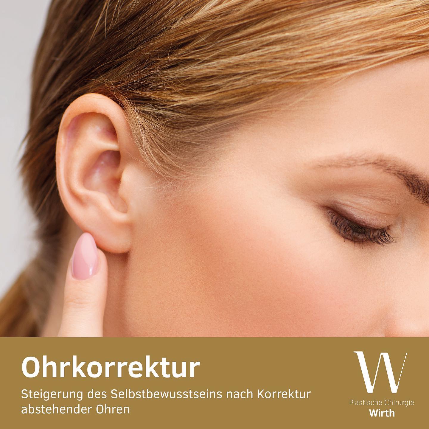 Ohrkorrektur (Otoplastik)
Abstehende Ohren, ob ein- oder beidseitig, sind in der Regel angeboren und gehen meist auf eine unvollständige Faltung des Ohrknorpels zurück.
Mit einer Operation lässt sich der Ohrknorpel neu formen und das Ohr anlegen. Dieser Eingriff kann in jedem Alter vorgenommen werden. Da der Eintritt in die Schule ein wesentliches Ereignis für die Kinder darstellt, sollte aus psychischen Gründen eine operative Korrektur vor Schuleintritt erfolgen. Sie ist jedoch auch bei grösseren Kindern oder im Erwachsenenalter möglich.
Correction des oreilles (otoplastie)
Les oreilles décollées, que ce soit d’un côté ou des deux, sont en règle générale une malformation congénitale résultant d’un manque de plicature du cartilage.
Une opération permet de remodeler le cartilage et de repositionner l’oreille. Cette intervention peut se faire à tout âge. Or, l’entrée à l’école représentant un événement important pour les enfants et en vue des possibles conséquences psychiques, une telle correction chirurgicale devrait se réaliser avant cette nouvelle étape de vie. L’opération est néanmoins possible chez les enfants plus âgés comme chez les adultes.
#praxiswirth #drmedraphaelwirth #plastischechirurgie #ohrkorrektur