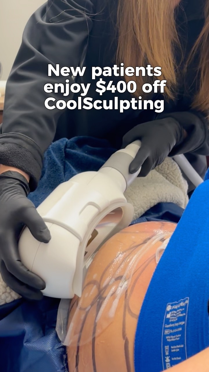Okay, if stubborn fat has been on your mind lately⌠listen up âď¸
CoolMonth begins April 1, and new CoolSculpting patients will be able to enjoy $400 off treatment through Alle.
CoolSculpting freezes stubborn fat cells and your body gradually clears them away over the following weeks.
No surgery. No downtime. Just smoother contours where you want them.
If youâve been thinking about it, now might be the time.
đ Call (318) 698-8711 to schedule a consultation.
#coolsculpting #coolsculptingshreveport #drkennethsanders #facefixr #shreveportbossier #shreveportmedspa