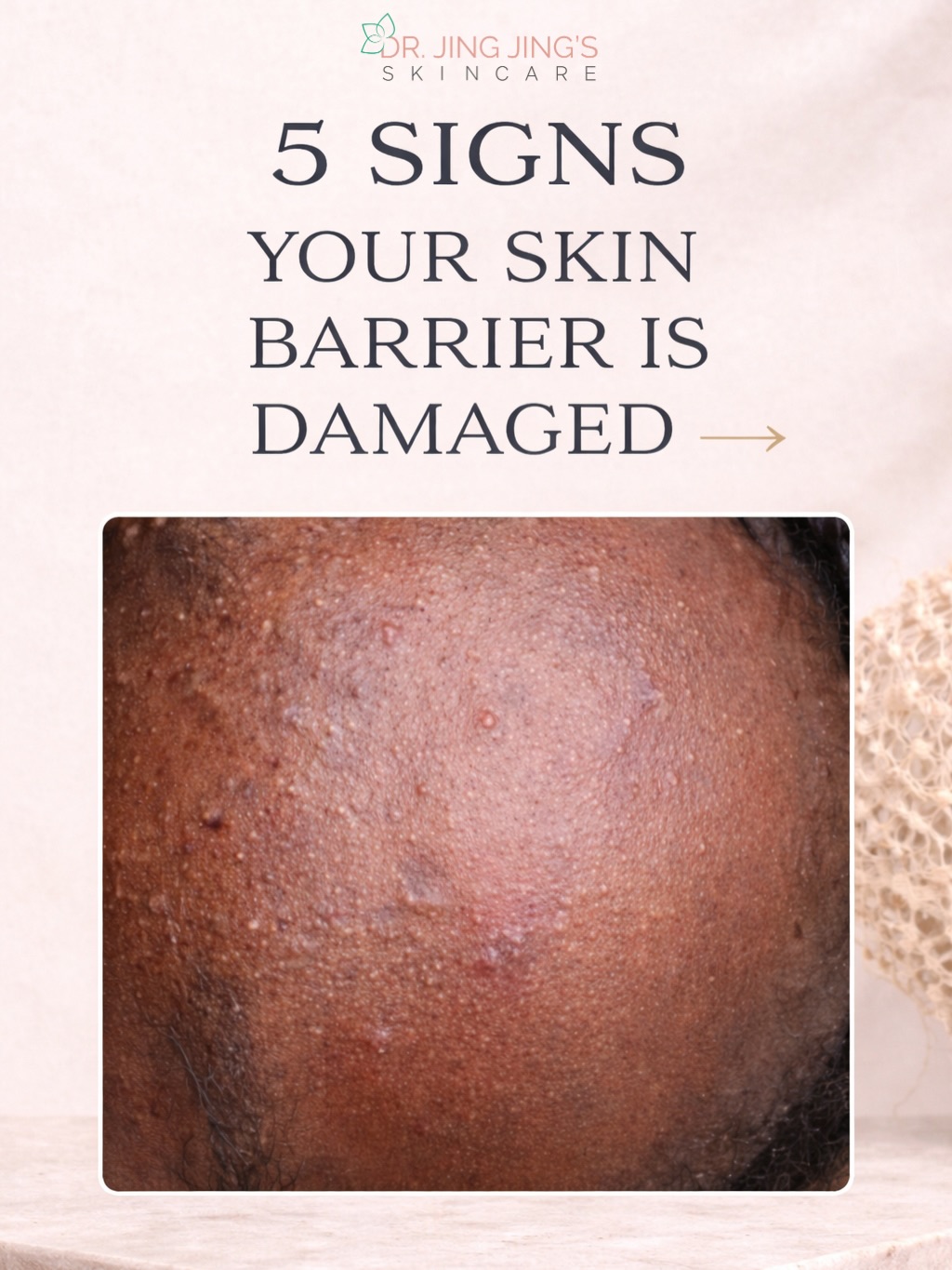 Your skin is trying to tell you something… 🤍
If your skin feels irritated, dry, or your products stopped working, your barrier needs repair.
Our Healing Cream + Healing Serum work together to:
✨ Hydrate & nourish
✨ Calm irritation
✨ Strengthen your skin barrier
✨ Restore balance
Healthy, glowing skin starts with repair.
#SkinBarrierRepair #HealingSkin #GlowingSkin #MelaninSkincare #PrettyFacesAtlanta