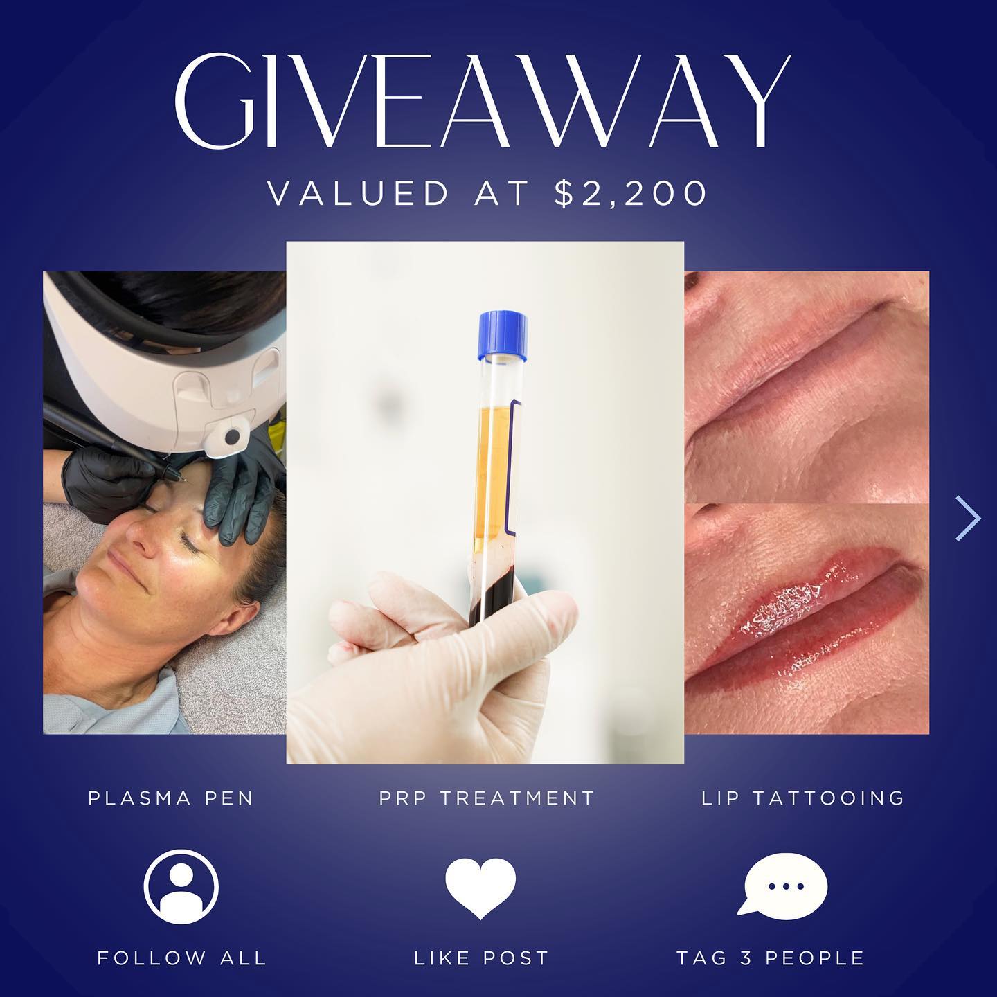 Unbelievable giveaway! Valued at $2,200 β¨ 3 amazing business have joined forces to bring you this ultimate giveaway! The winner will win the following:
1. 1 free PRP treatment at @dermalign
2. 1 free lip tattooing session + touch up with @byjarnamarie
3. $500 gift card for a plasma pen treatment with @_ashhawkins
To be in the draw you must:
1. Follow all 3 accounts
@dermalign
@_ashhawkins
@byjarnamarie
2. Like this post
3. Tag 3 friends
Winner announced July 31st! GOOD LUCK! β¨