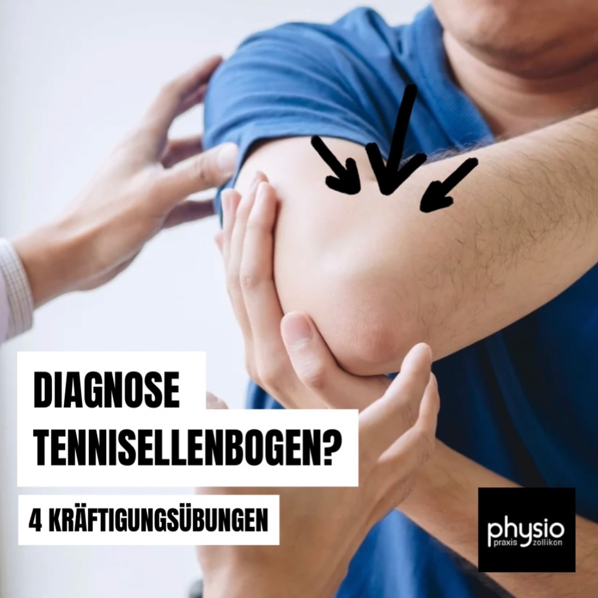 ‼️Diagnose Tennisellenbogen ‼️
Hierbei handelt es sich um eine Sehnenentzündung der Handgelenkstrecker, die meist durch Überlastung entstehen.
⚠️🧠 Die aktuelle Studienlage empfiehlt bei der Rehabilitation ein „heavy slow resistance Training“ sowie ein Belastungsmanagement.
Hier siehst du ein paar exemplarische Übungen zur Kräftigung der Unterarmmuskulatur mit Fokus auf die Handgelenksstrecker zur Verbesserung der Kraft und Schmerzlinderung.
⚠️Ein evidenzbasiertes Training solltest du wie folgt durchführen:
3 Sätze, mit 10 bis 12 Wiederholungen, 3 mal wöchentlich, mit keinen Schmerzen bis leichte/moderate Schmerzen (die danach schnell verschwinden) während und nach der Übungsausführung, über mind. 6 Wochen.💪🏽
🔜 Bleib dran und erfahre Im nächsten Post mehr über das Belastungsmanagement bei Tendinopathien.
Haftungsausschluss: Die Inhalte werden mit großer Sorgfalt ausgearbeitet, ersetzen jedoch keine individuelle fachliche Untersuchung und Behandlung durch einen Arzt oder Physiotherapeuten.
⚠️💪🏽 Möchtest du einen individuelleren Reha- oder
Trainingsplan um deine Ziele zu erreichen, vereinbare gerne einen Termin in unserer Praxis. Denn Link dazu findest du oben in der Bio auf unserem Profil.
#rehab #exercises #training #ellbow #tennisellenbogen #strengthtraining #tendinopathy #physiopraxiszollikon #health #physiotherapie #physio #physiotherapy #gesundheit #sport #training #fitness #therapie #physiotherapeut #physiolife #bewegung #moveyourbody #zollikon #zürich