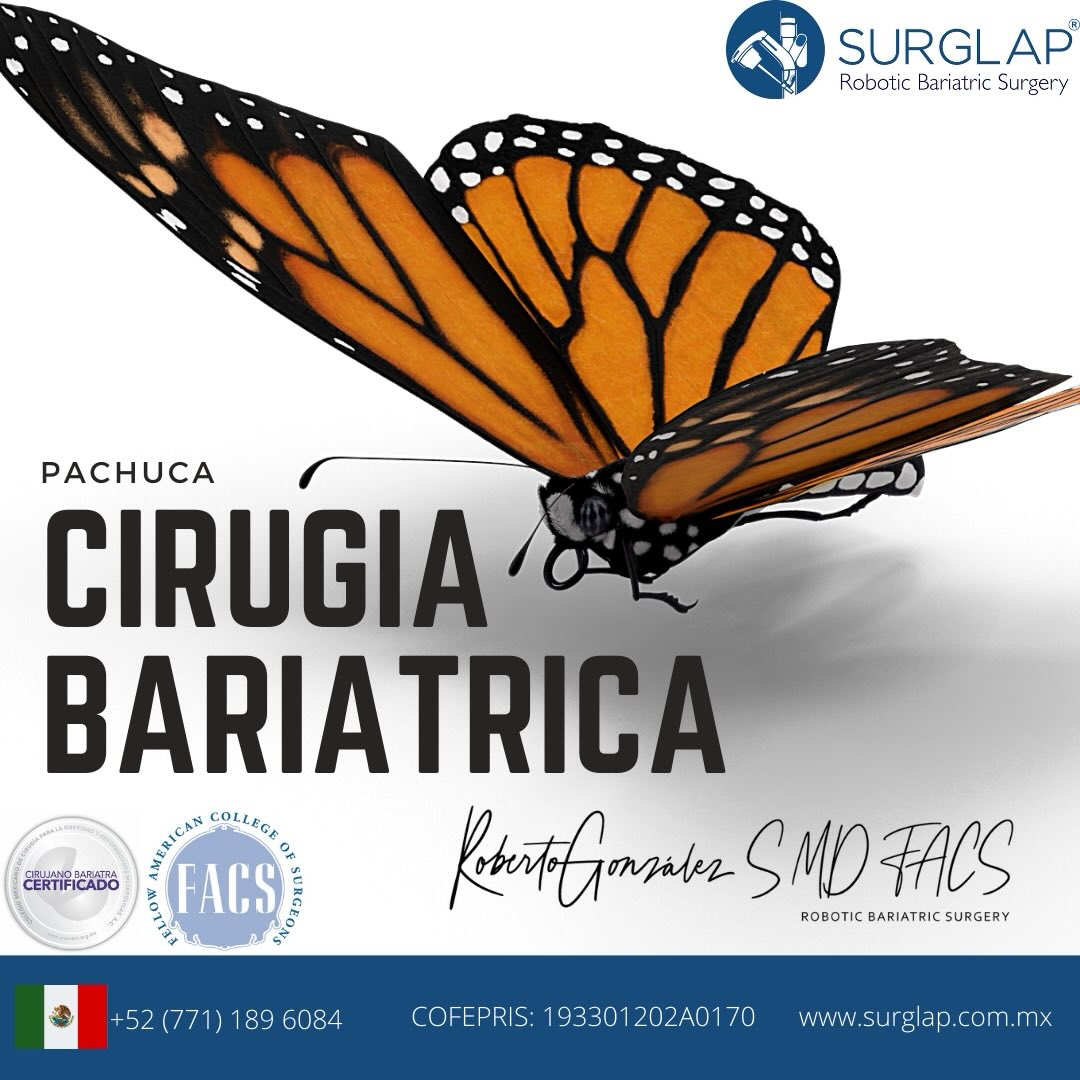 Hay decisiones que cambian tu vida…
y tu salud es una de ellas.
Si llevas tiempo postergando ese paso por miedo, dudas o malas experiencias, no estás solo.
Cada paciente tiene una historia, y mi compromiso es acompañarte en la tuya con seguridad, experiencia y tecnología de vanguardia.
🩺 DR. JUAN ROBERTO GONZÁLEZ SANTAMARÍA
Cirujano General | Cirujano Bariatra | Cirugía Robótica
Fellow del American College of Surgeons
Especialista en:
✔ Cirugía general
✔ Cirugía bariátrica
✔ Cirugía robótica
Procedimientos mínimamente invasivos, enfocados en tu recuperación, tu bienestar y tu confianza.
📍 Hospital Español Pachuca
Consultorio 23
📲 Agenda tu valoración por WhatsApp
Atención directa y personalizada
Hoy puede ser el inicio de una nueva etapa.