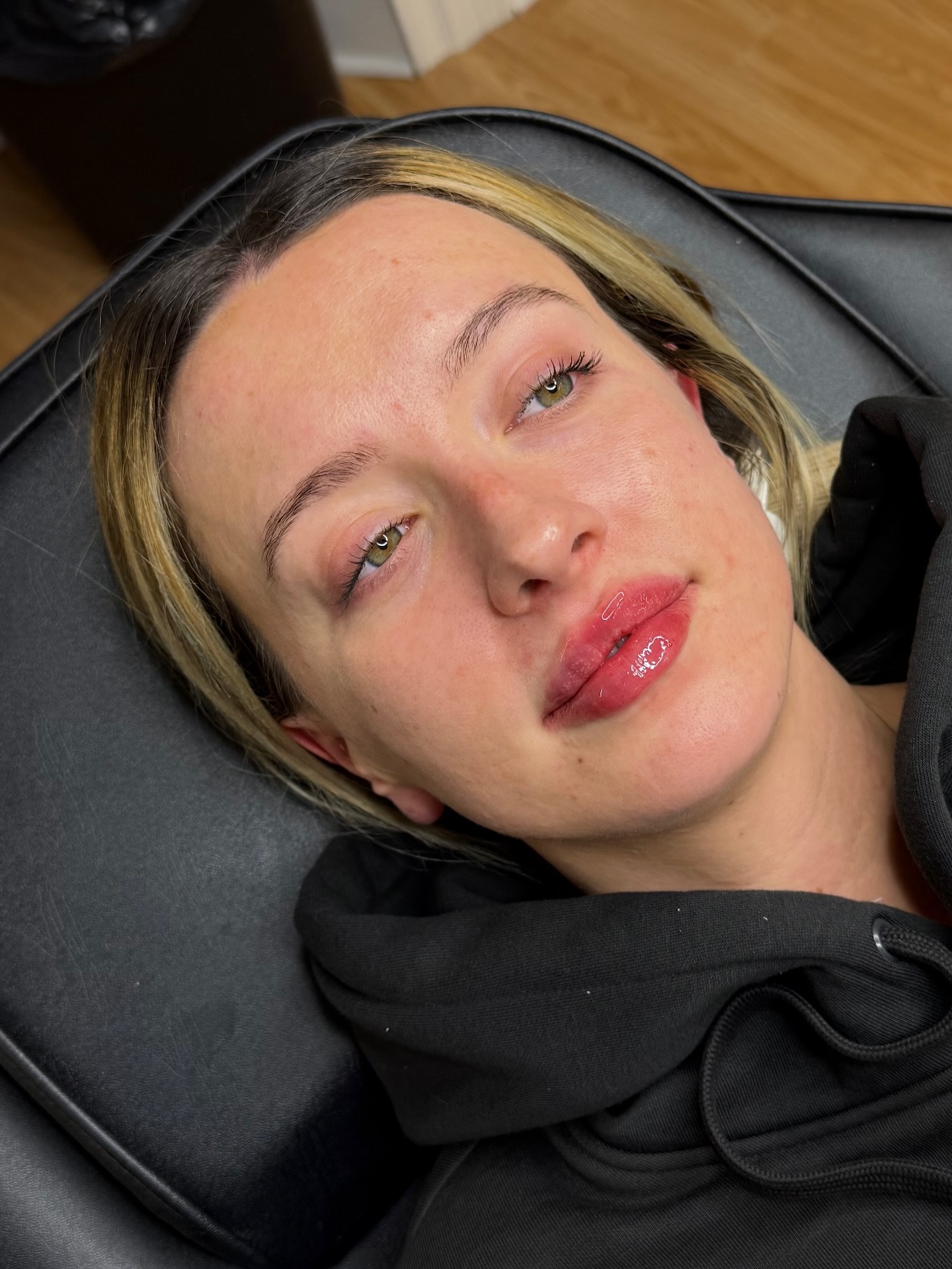 Gorgeous lip filler results using 0.7ml of rha kiss @teoxane_uk Natural but defined & plump just the way we like it 💉👄
#lipfiller #aesthetics #sunderlandaesthetics #aestheticspractitioner #aestheticsclinic #sunderland